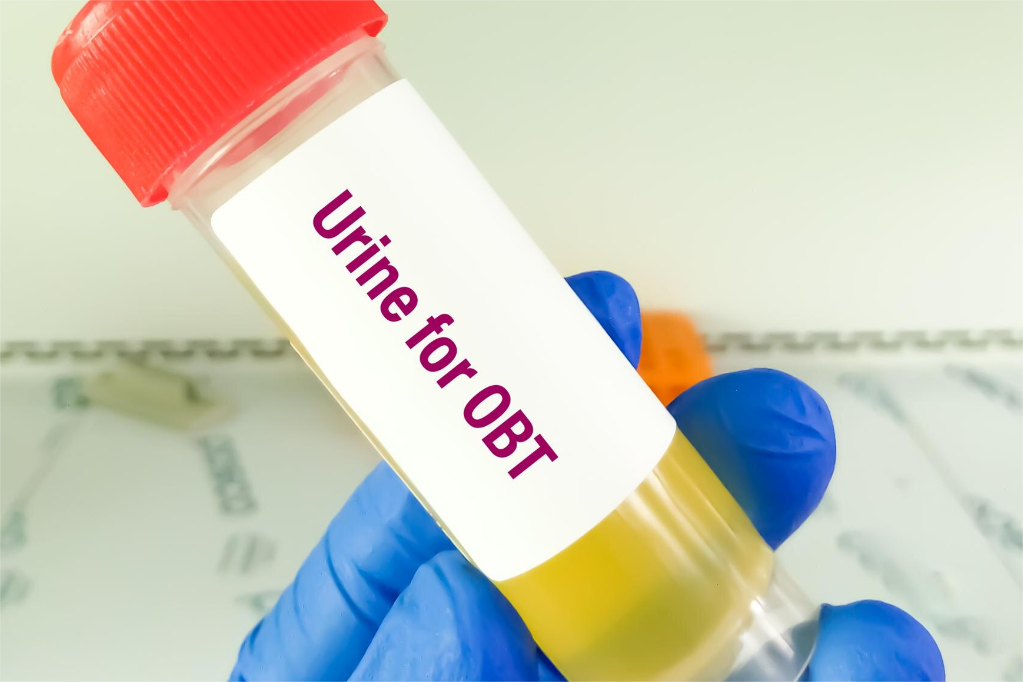 ACIDO METILHIPURICO ORINA (metabolito del Xileno)