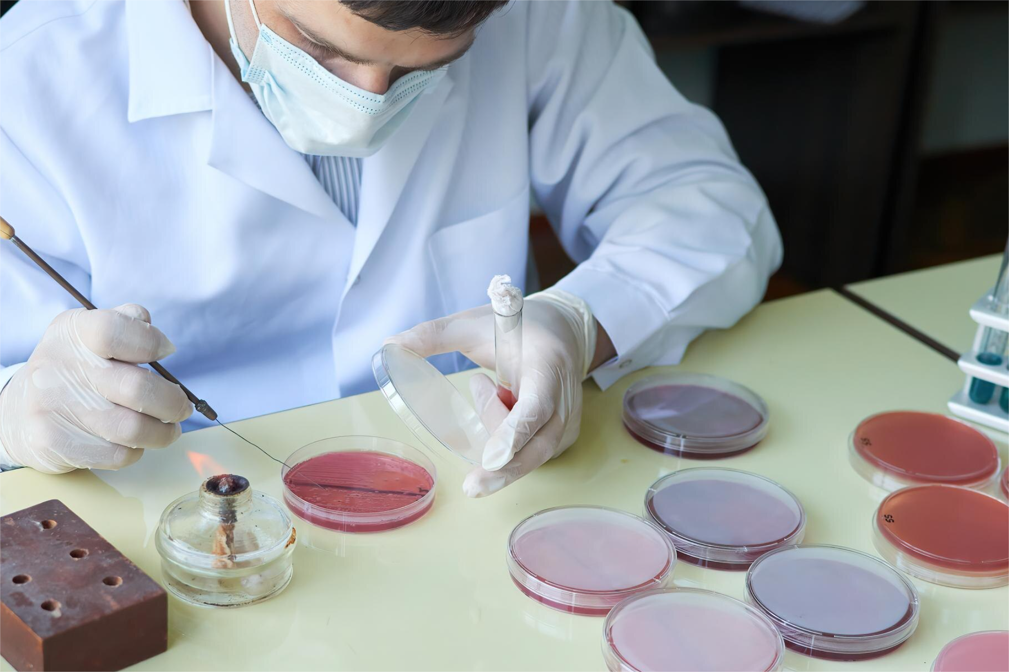 LINFOCITOS TOTALES (POBLACIONES LINFOCITARIAS)