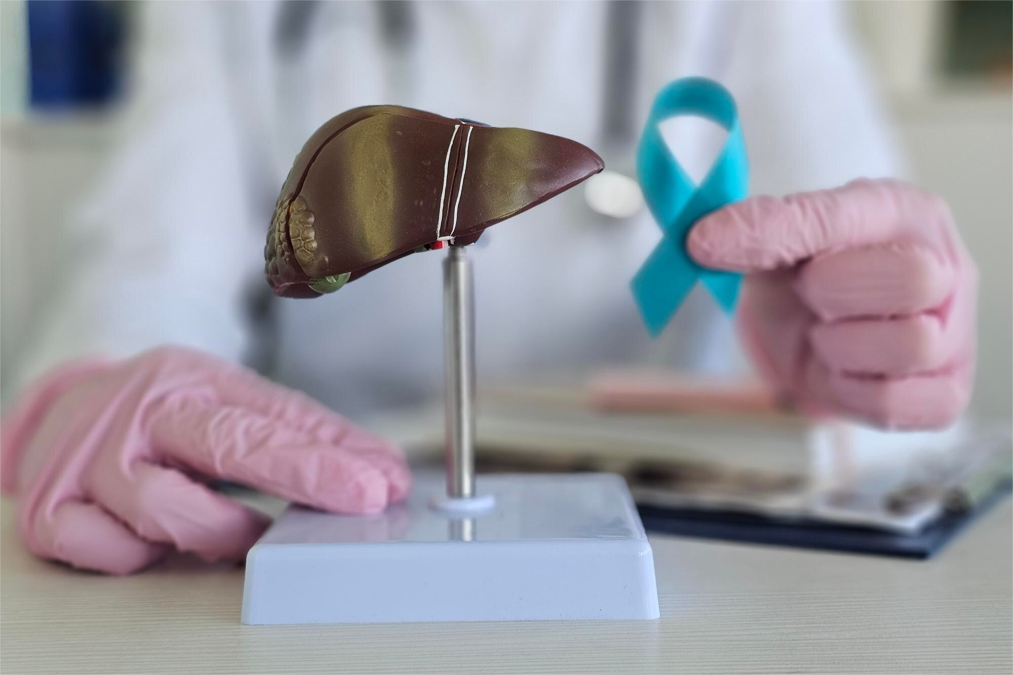 Perfil, Normetanefrina en plasma