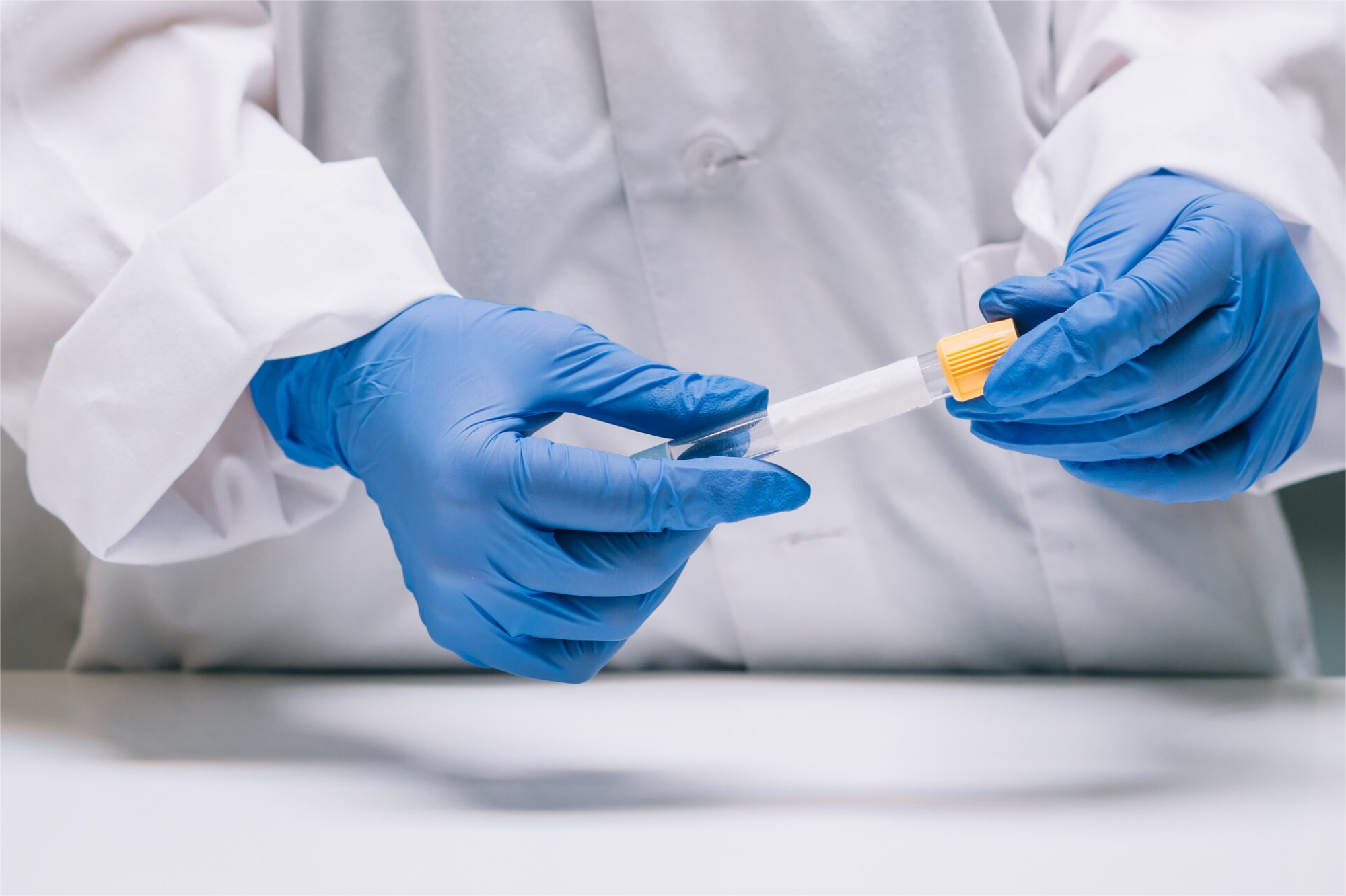 ACIDO LACTICO (LACTATO) PLASMA