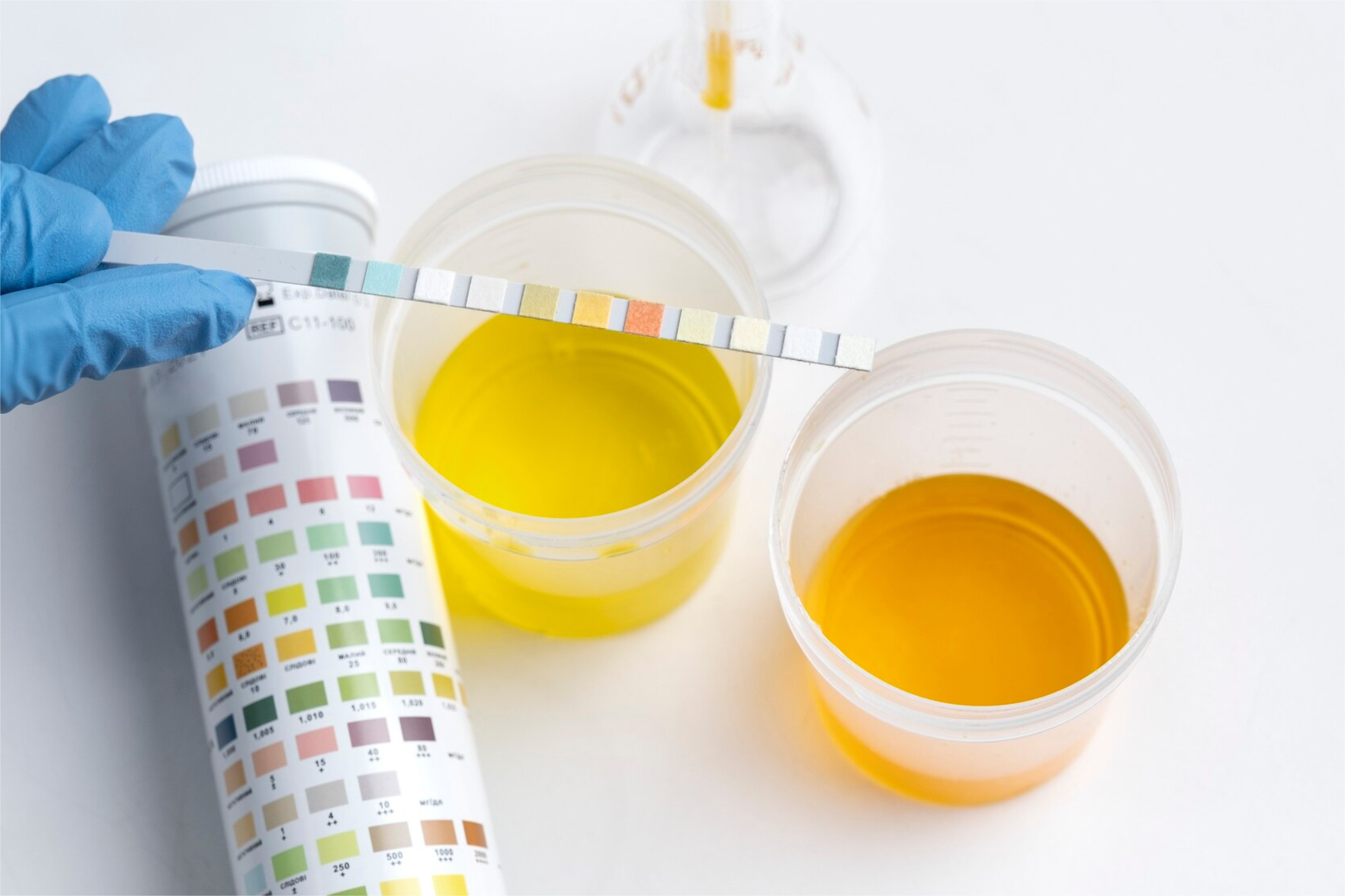 QSALUD ACIDO URICO ORINA