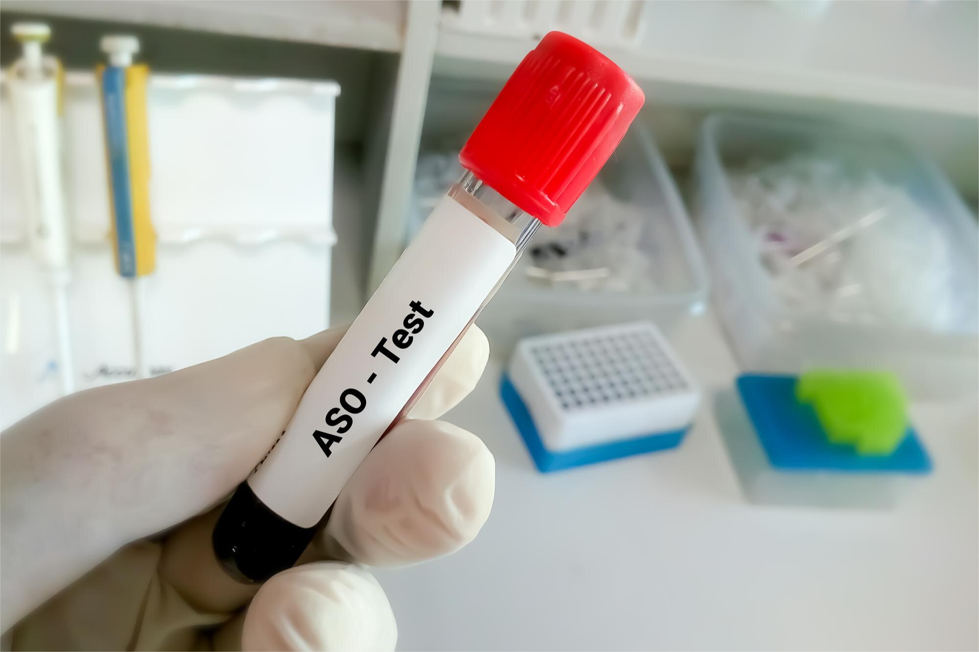 ANTIESTREPTOLISINA O