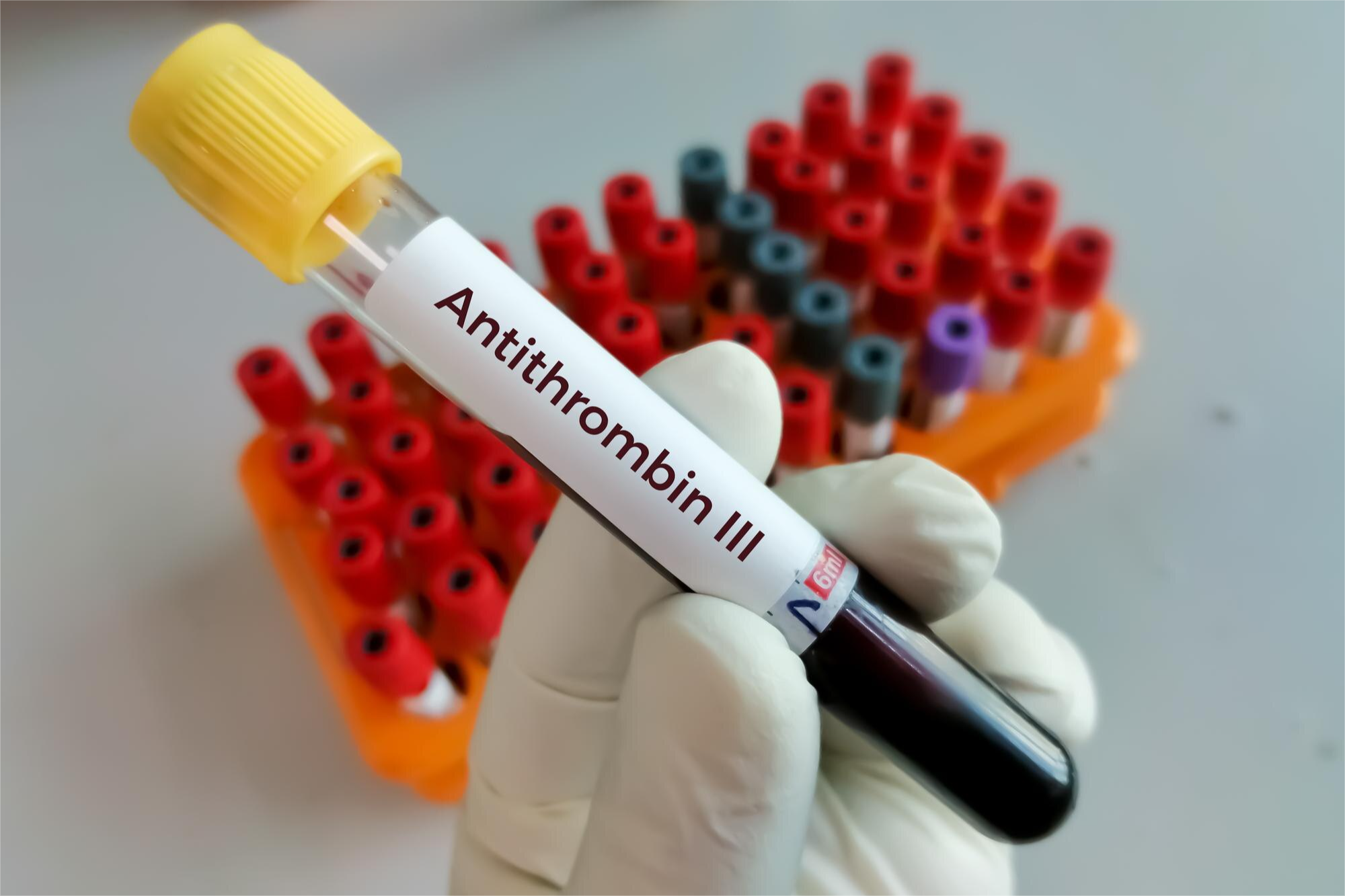 QSALUD ANTITROMBINA III