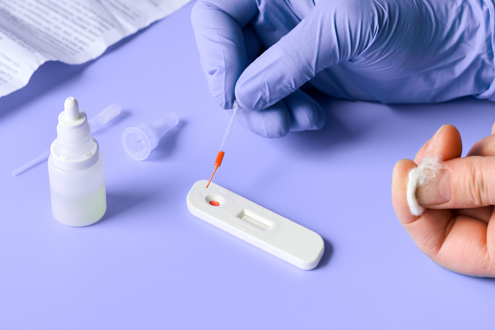 BETA-2 GLICOPROTEINA I AC. IGM