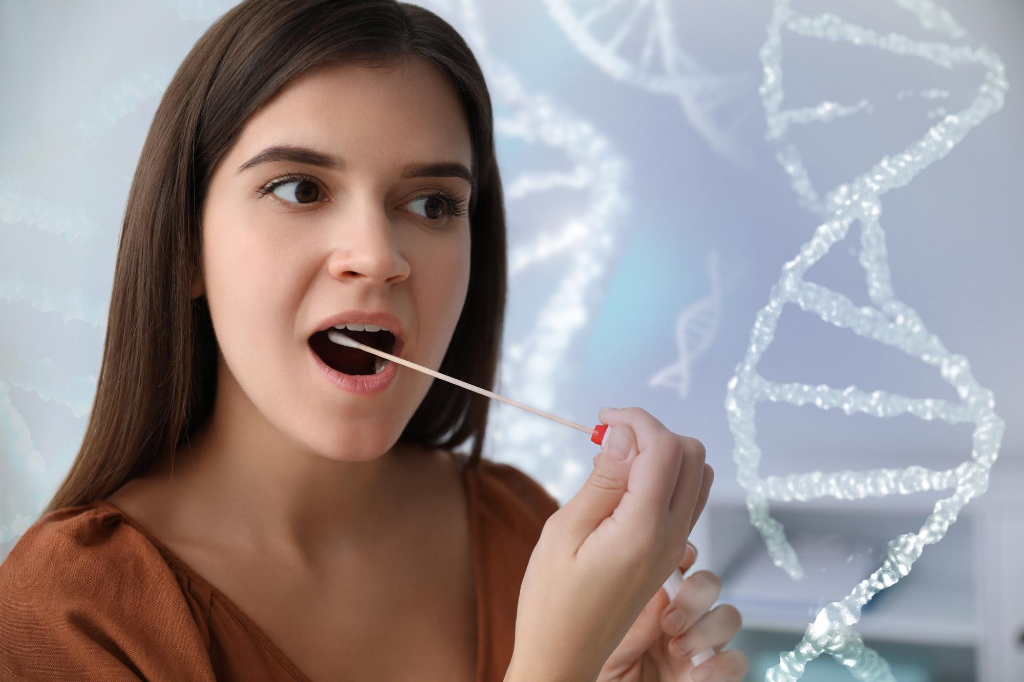 Bacterias periodontales DNA PCR Cualitativa
