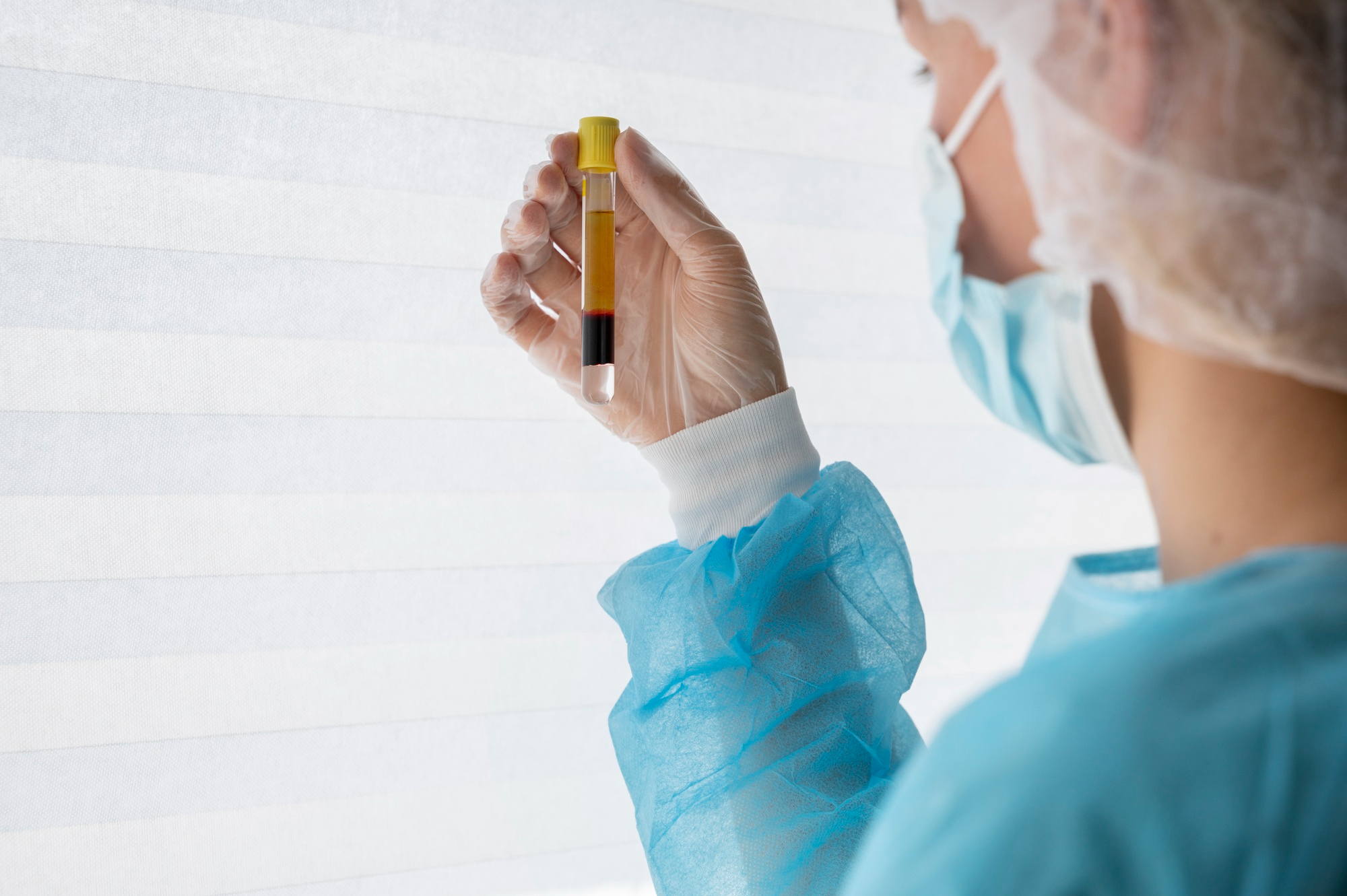 CERULOPLASMINA SUERO