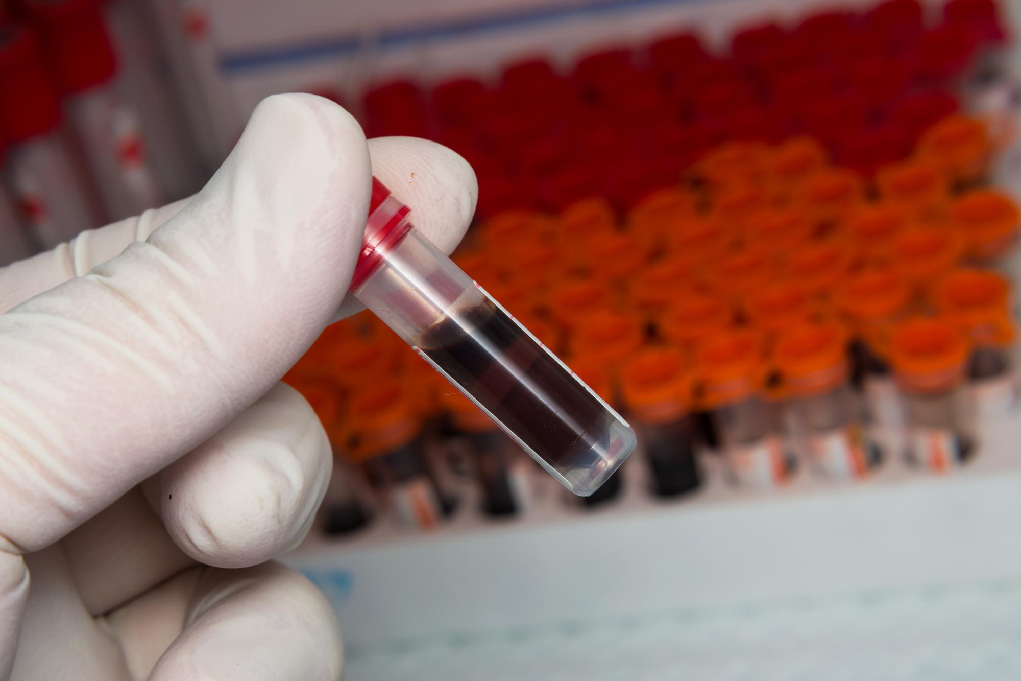 COMPLEMENTO C-3 SUERO