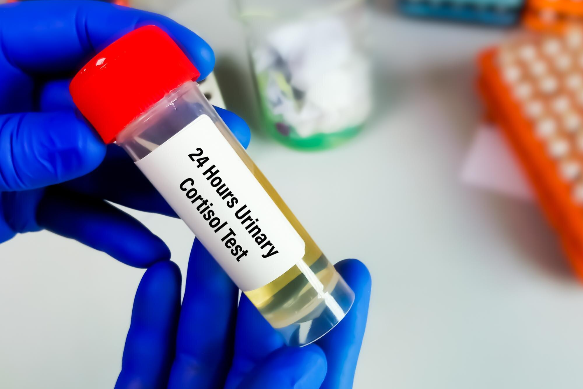 CORTISOL LIBRE URINARIO