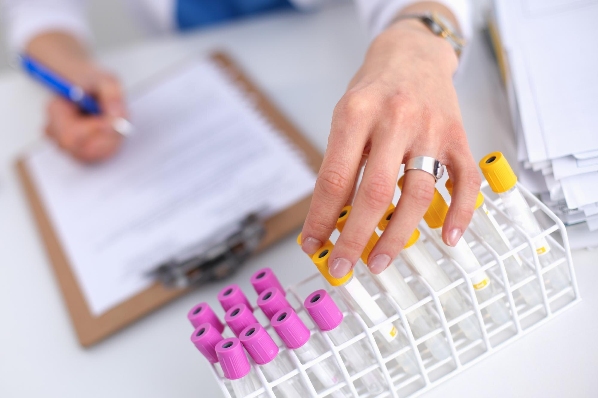 DEHIDROEPIANDROSTERONA-S