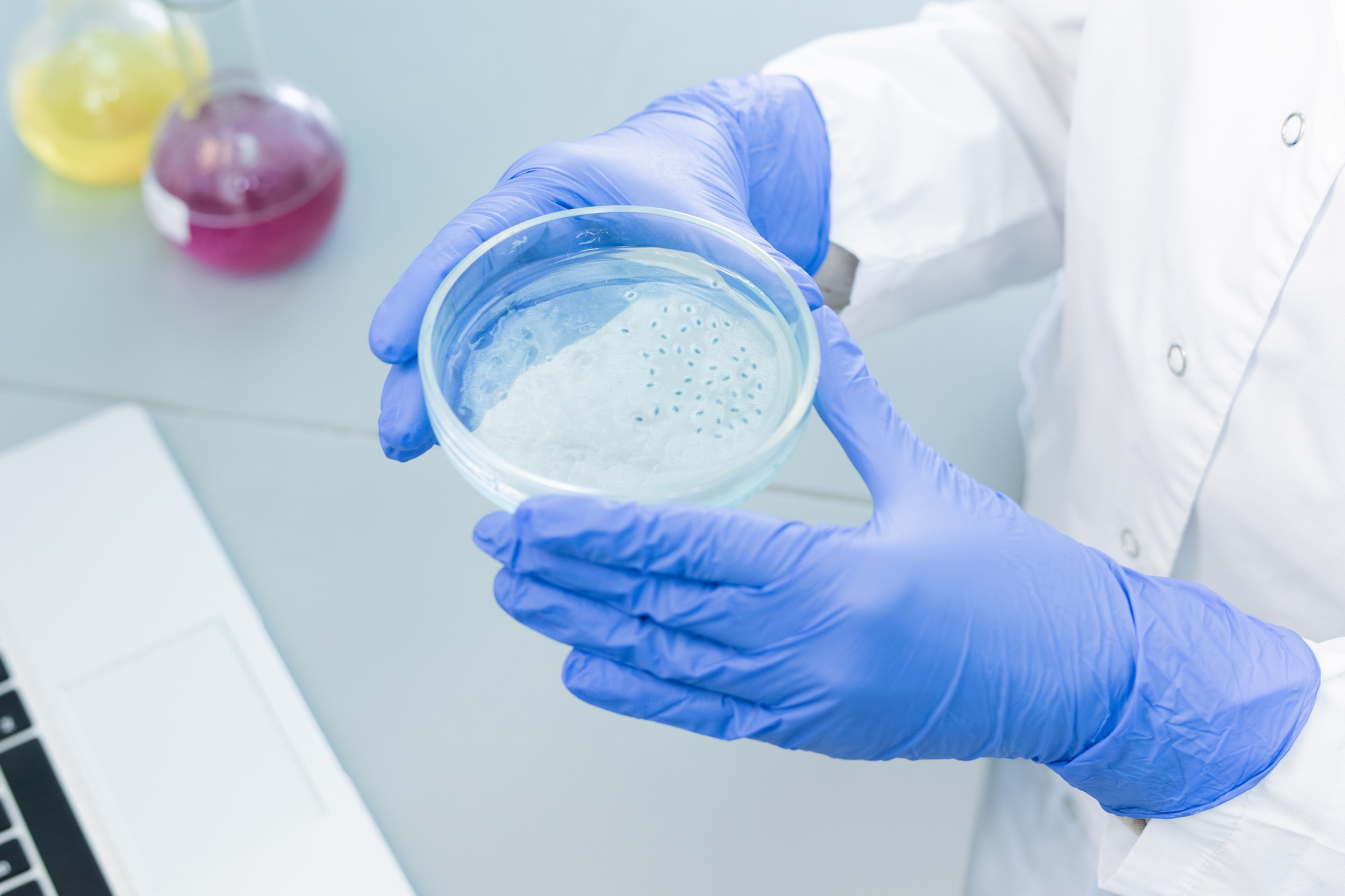 DETECCIÓN DE HONGOS