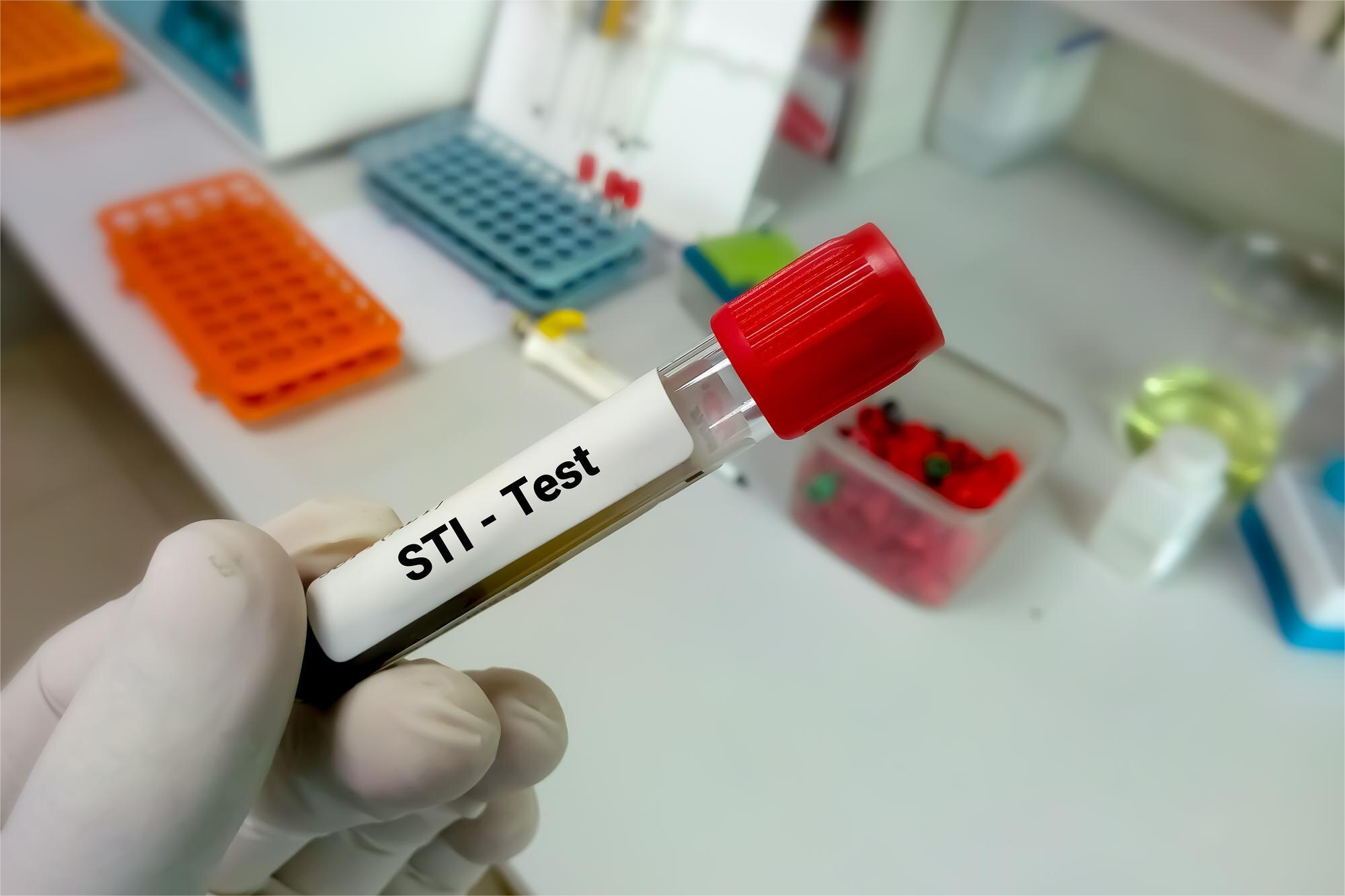 Detección por PCR de 7 patógenos de transmisión sexual