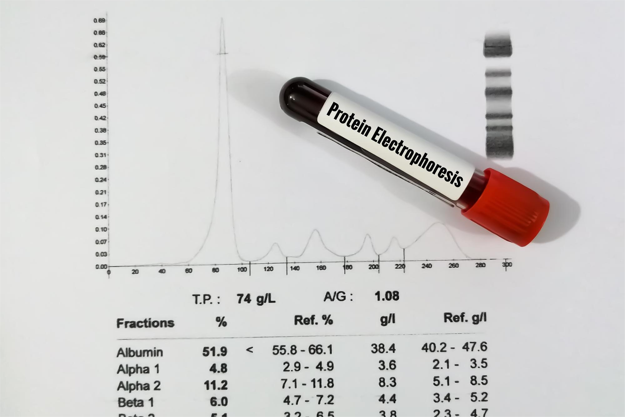 ELECTROFORESIS DE PROTEINAS SU