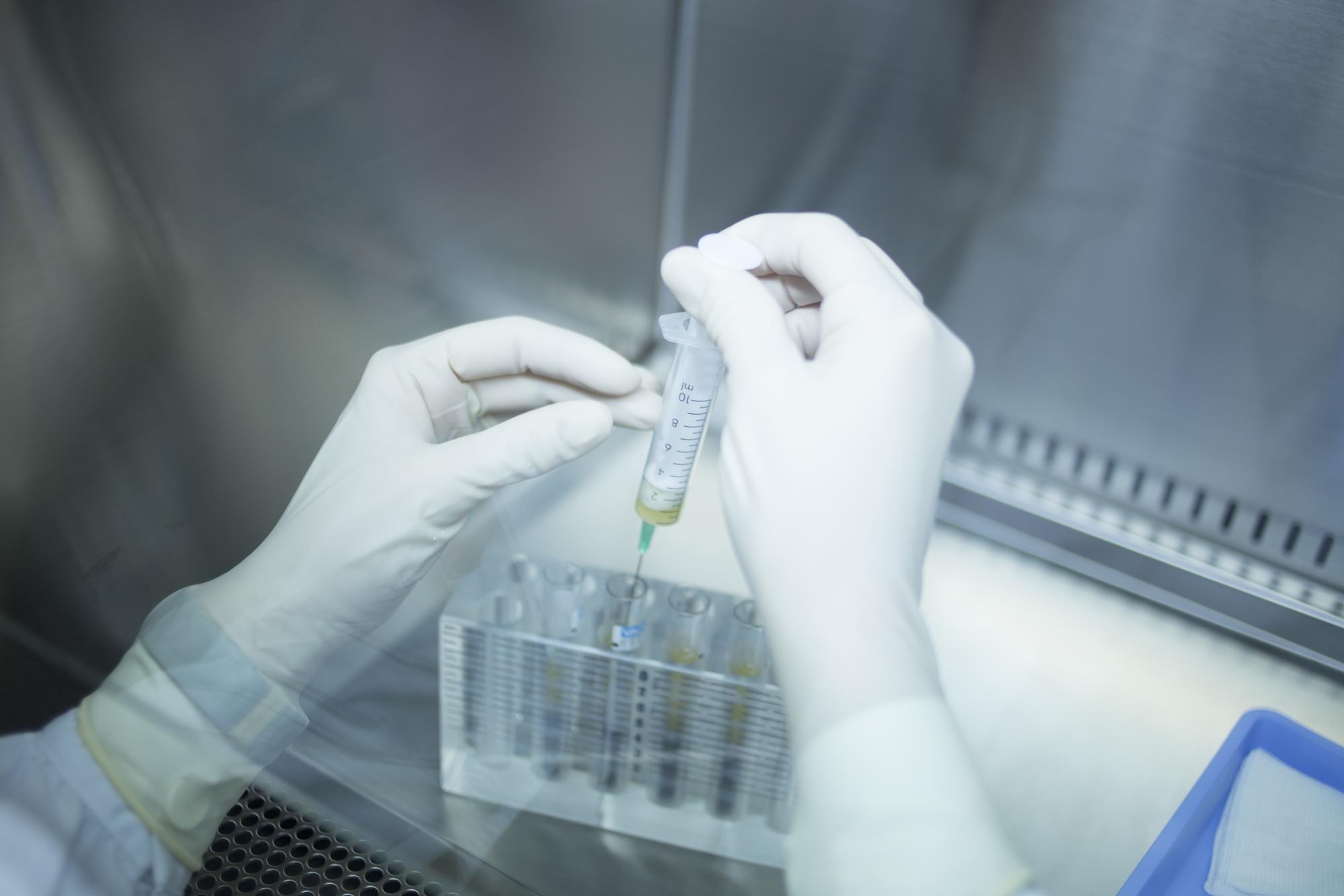 ENA (ANTIGENOS NUCLEARES EXTRAIBLES) AC. SUERO