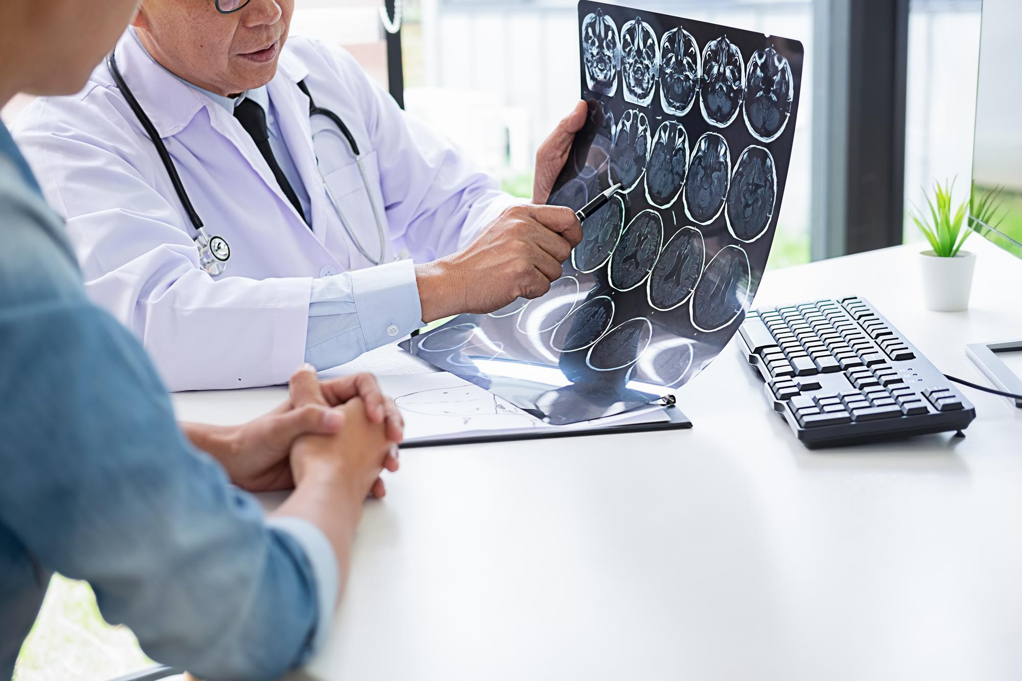 ENOLASA NEURONAL ESPECIFICA SUERO