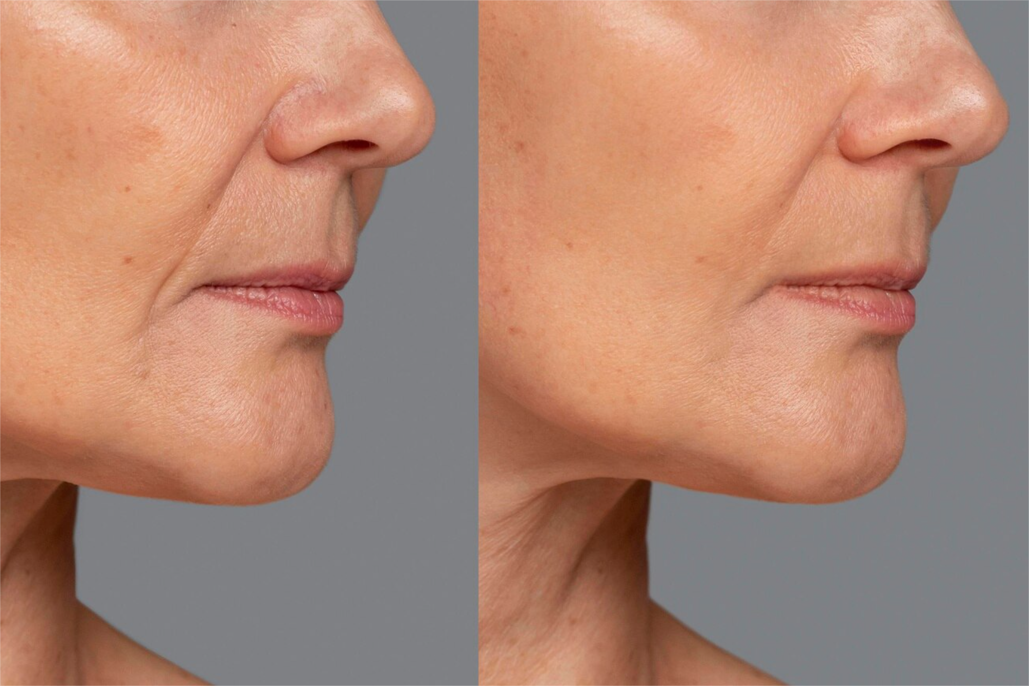 ENVEJECIMIENTO CUTANEO GENES RELACIONADOS (SKIN FACIAL)