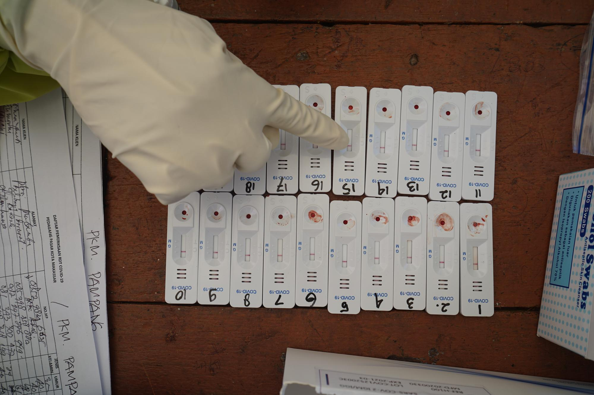 EPSTEIN-BARR AC. EARLY ANTIGEN IGG