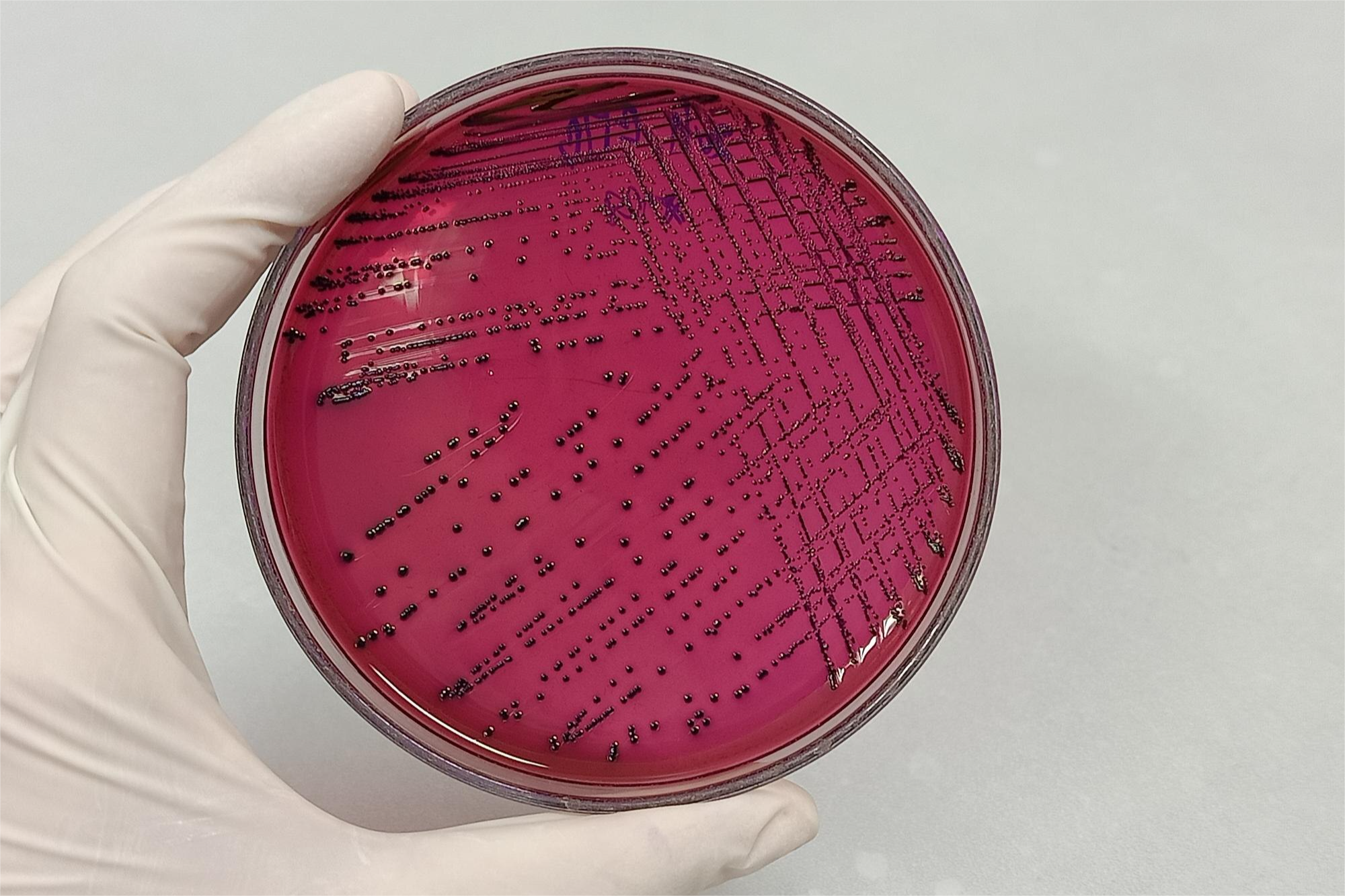 EXUDADO VAGINAL CULTIVO, IDENTIFICACION