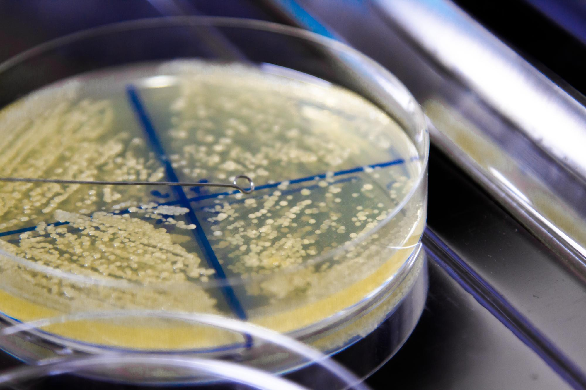FILTRADO GLOMERULAR ESTIMADO (MDRD-4 IDMS)