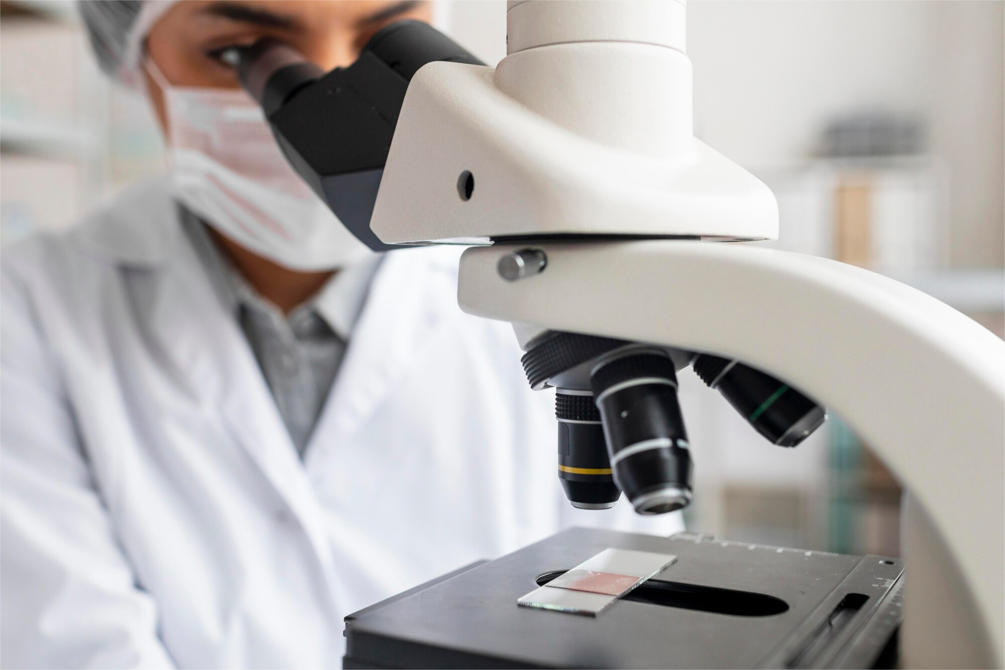 FROTIS DE SANGRE PERIFERICA