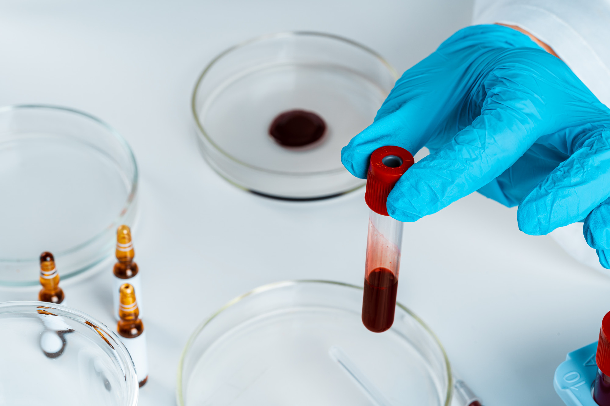 GLIADINA AC. IGG SUERO