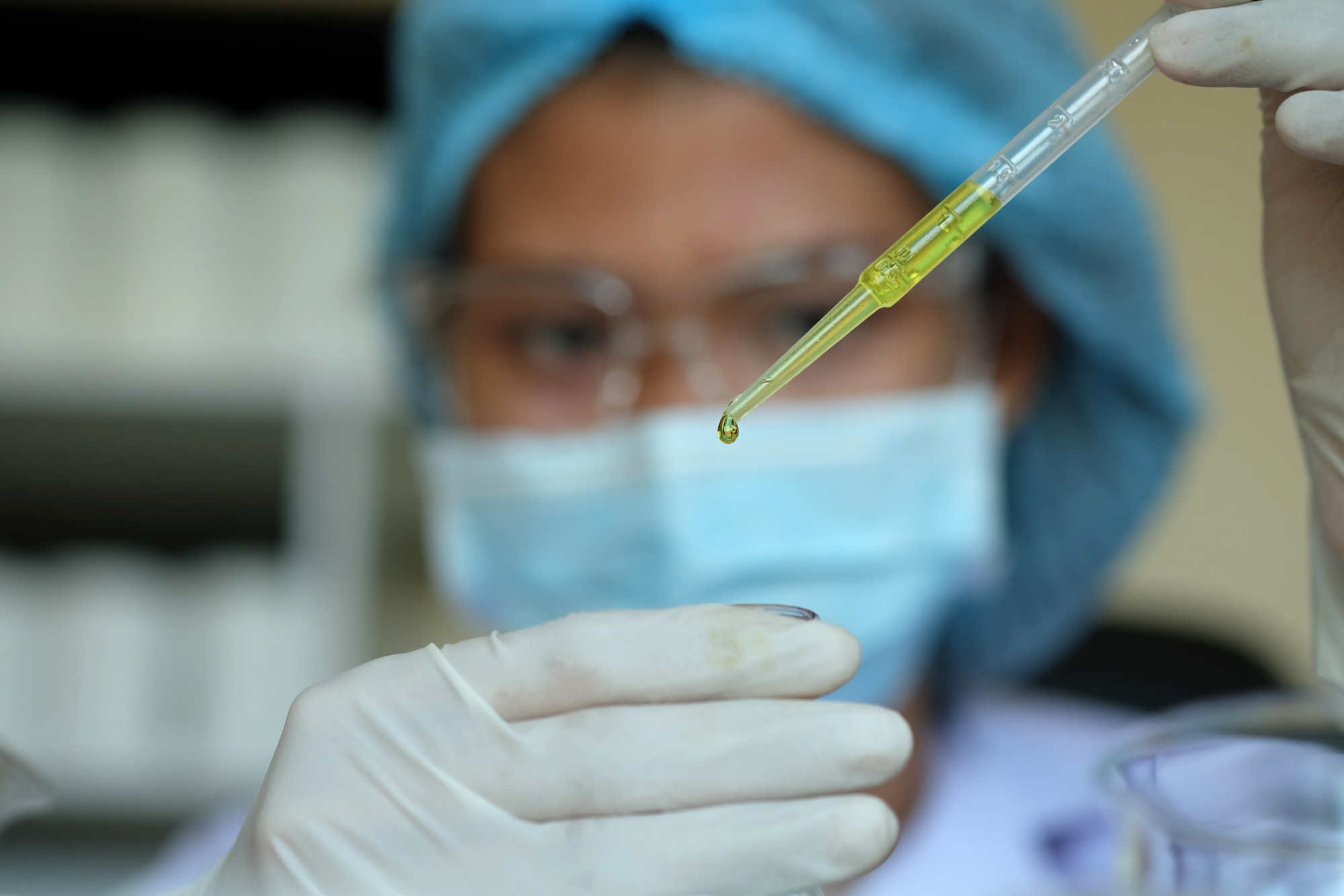 HELICOBACTER PYLORI AC. IGM SUERO