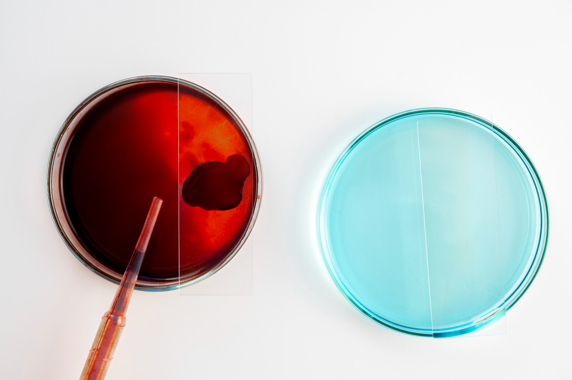 HEMOCULTIVO (CULTIVO DE SANGRE