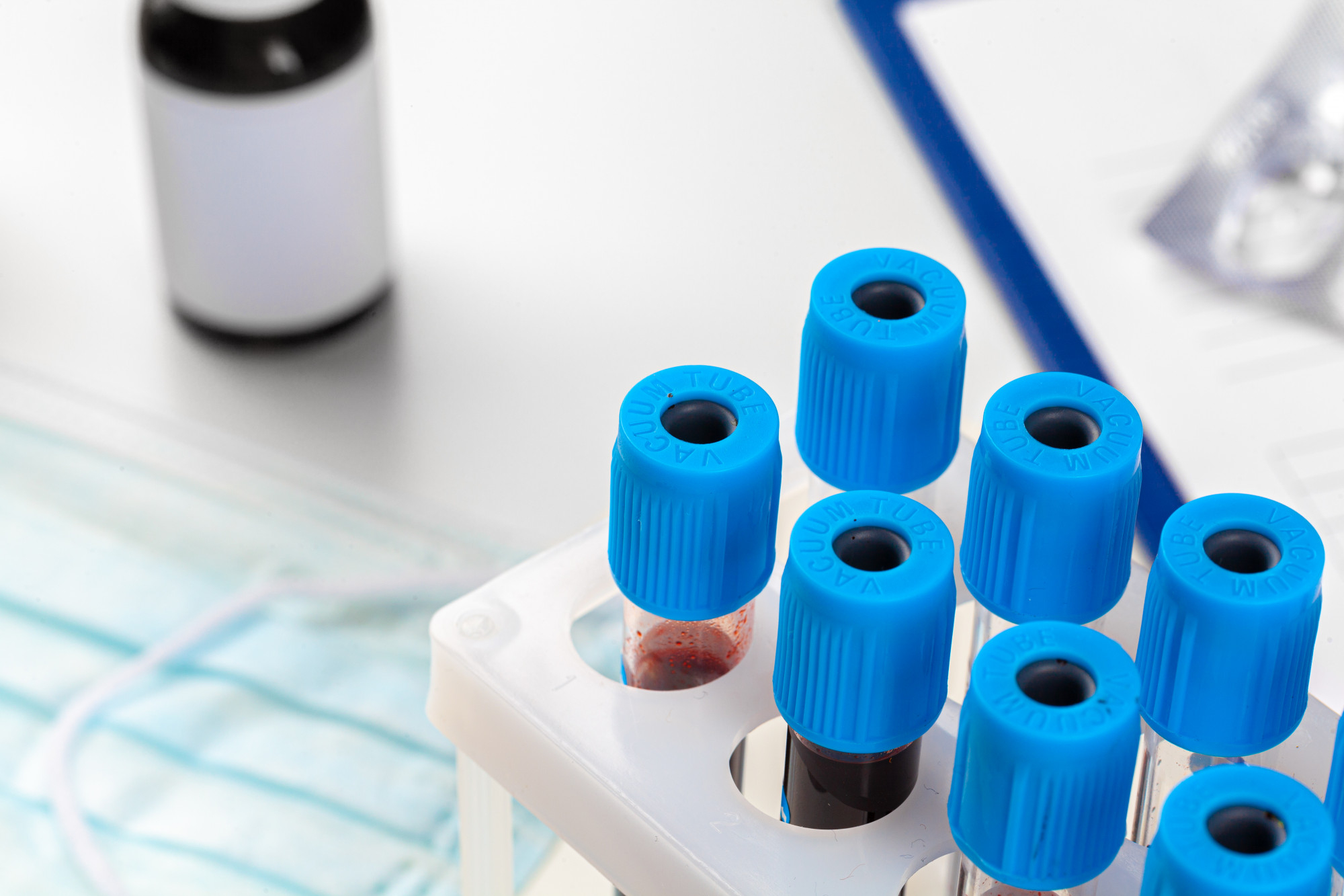 HEMOGLOBINAS ELECTROFORESIS SANGRE