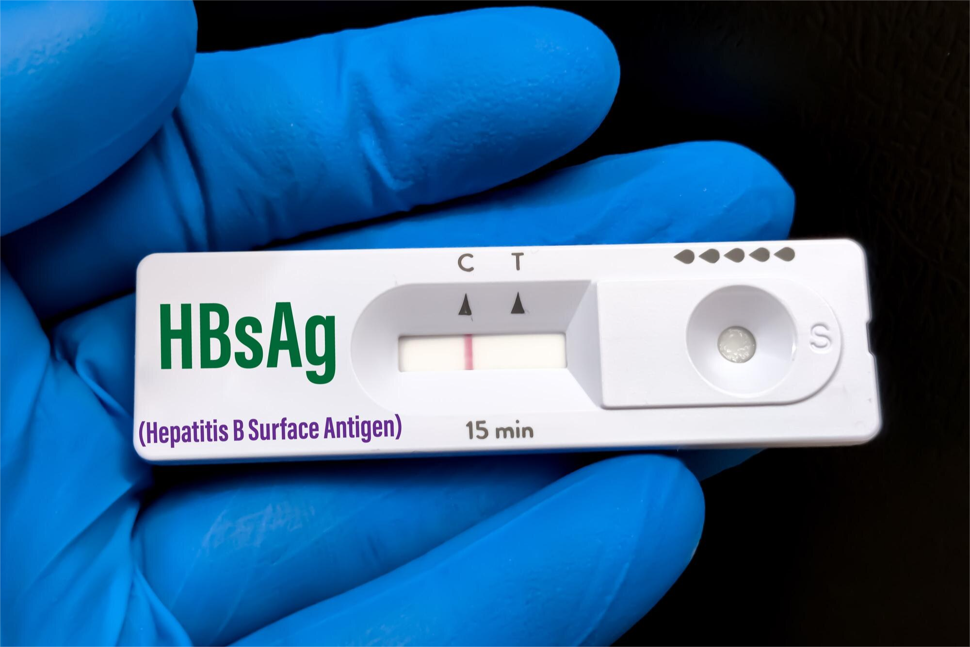 HEPATITIS B AC. SUPERFICIE