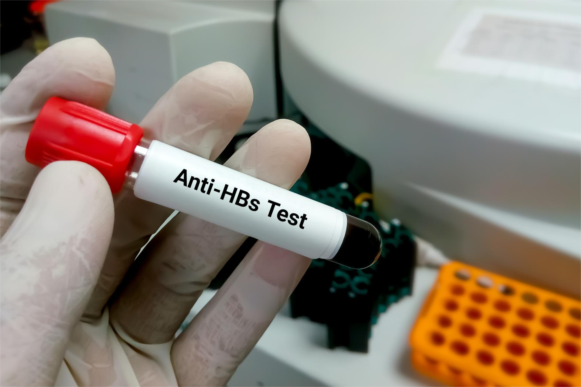 HEPATITIS B ANTICUERPOS ANTI-E