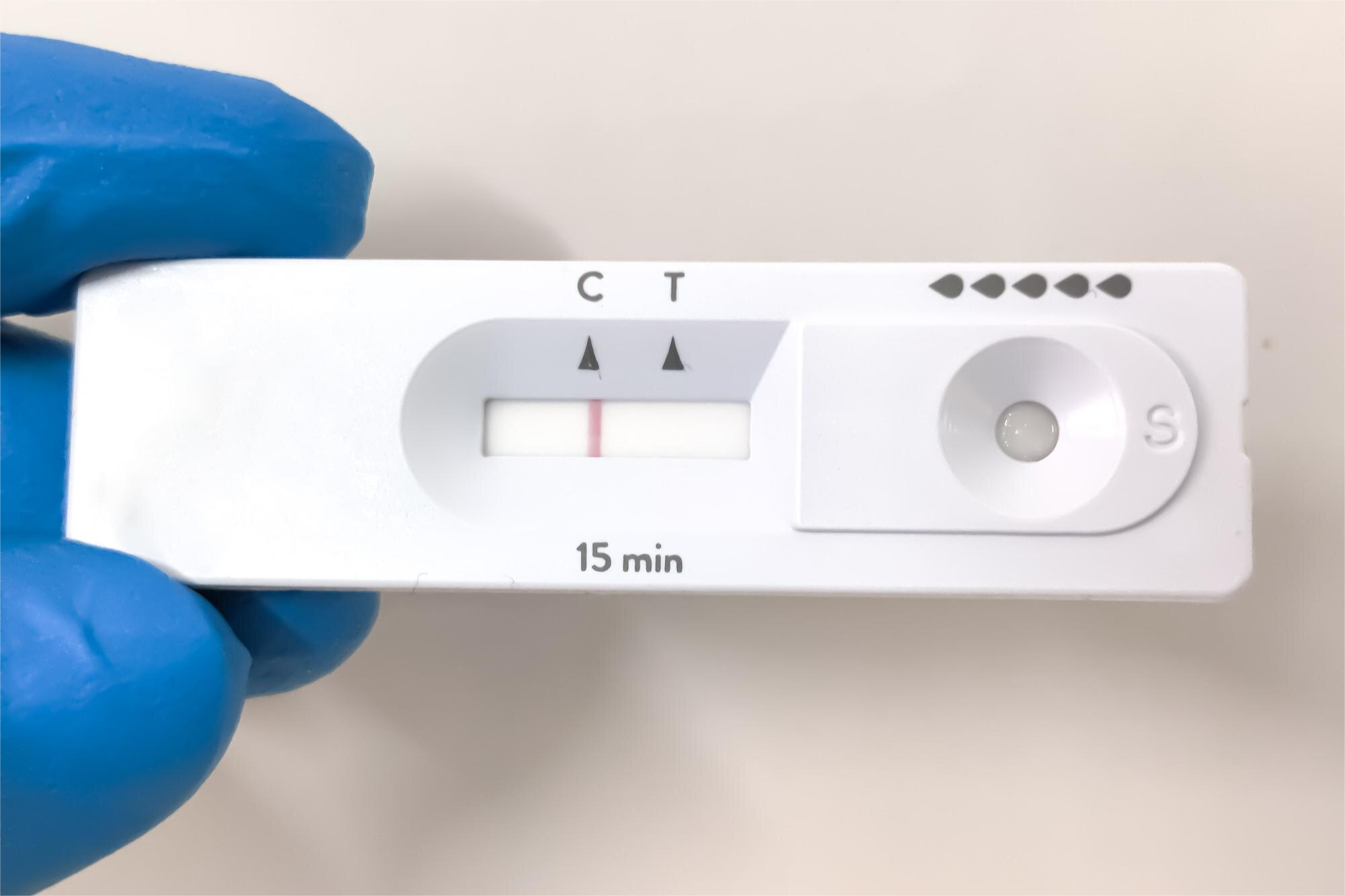 HEPATITIS B ANTIGENO DE SUPERFICIE