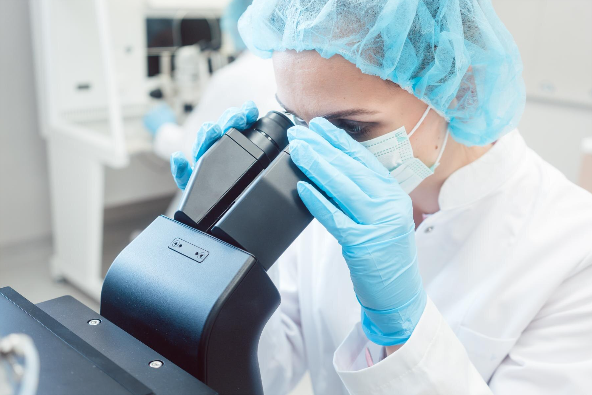 HEPATITIS C ANTICUERPOS IgG