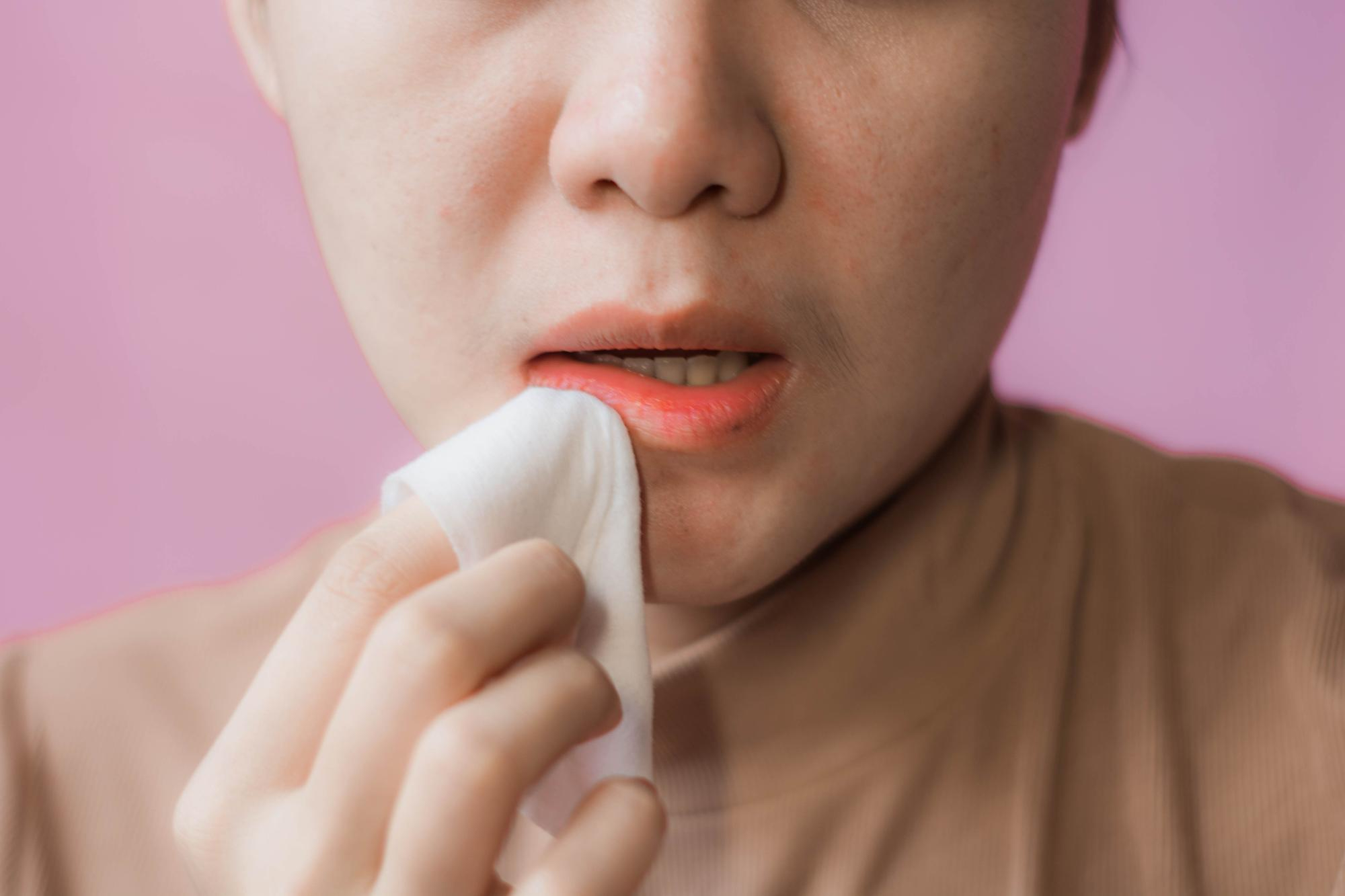 HERPES SIMPLE TIPO I AC. IGG SUERO ( HOMINIS)