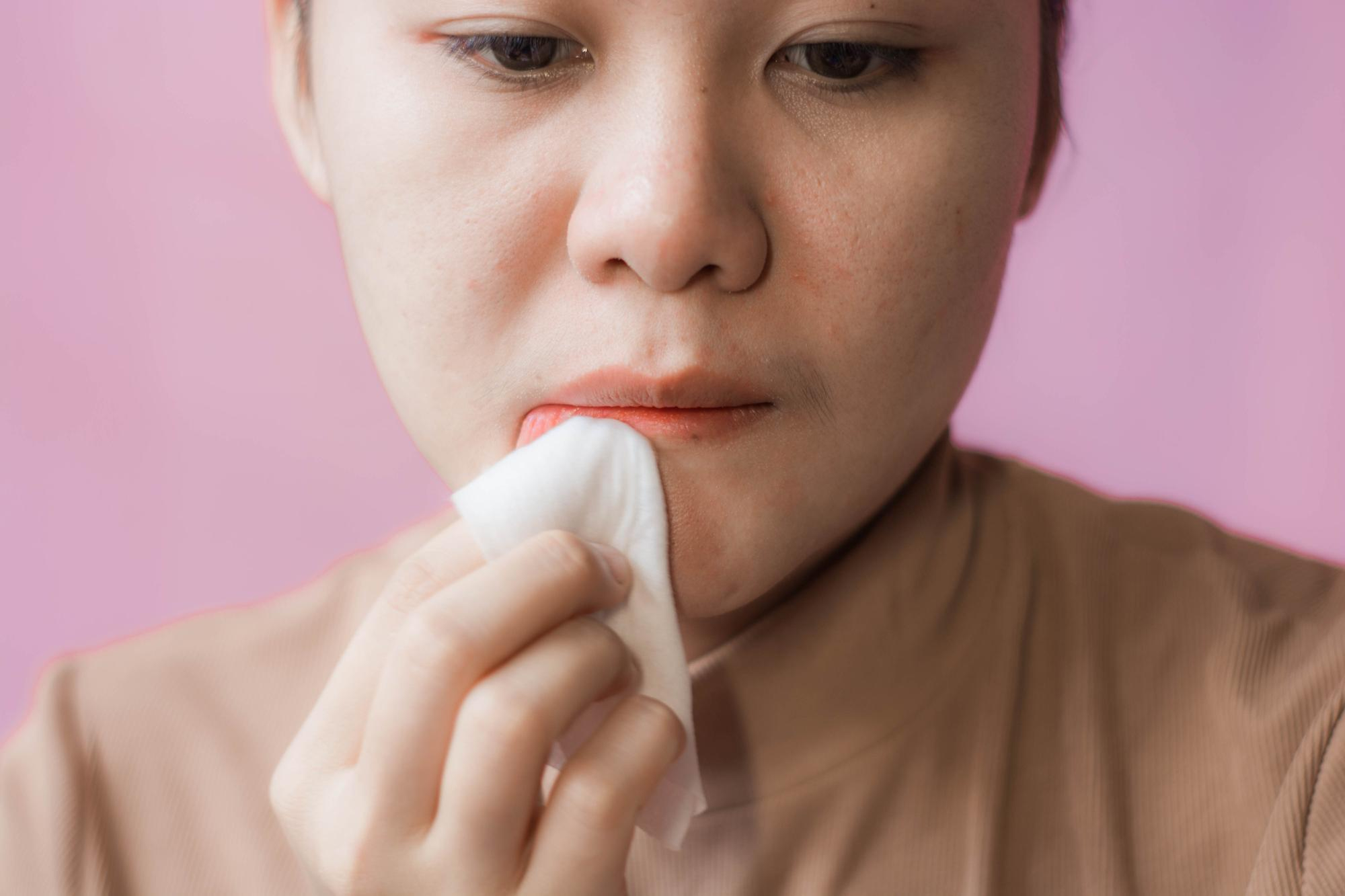 HERPES SIMPLE TIPO II AC. IGG SUERO ( HOMINIS )