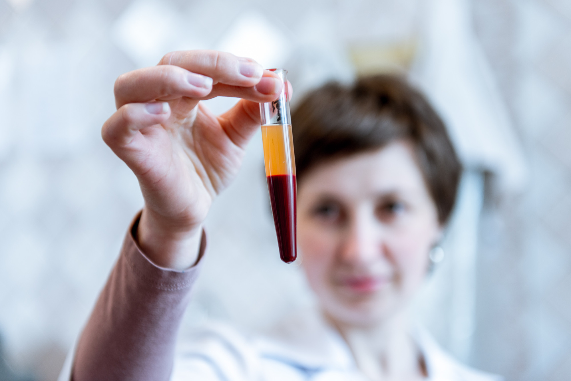 HOMOCISTEINA TOTAL EN SUERO