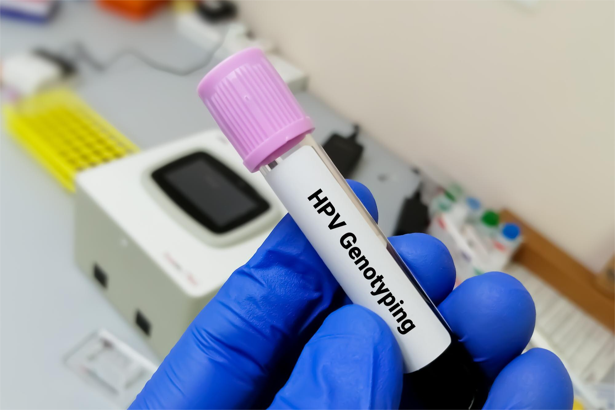 HPV DNA PCR Cualitativa + Genotipo