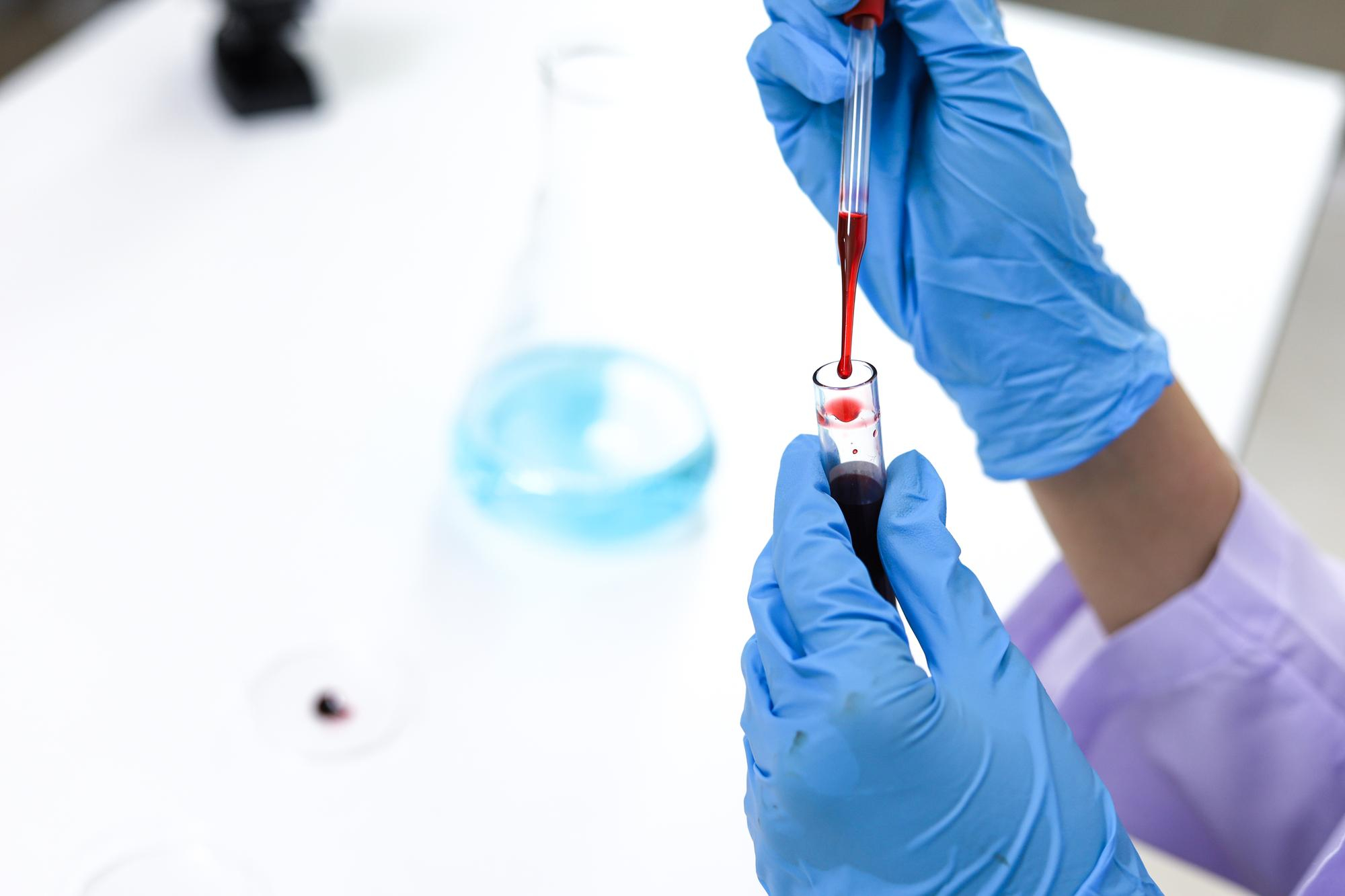 IGE ESPECIFICA A RECOMBINANTE rTri a 19 Omega-5 Gliadina