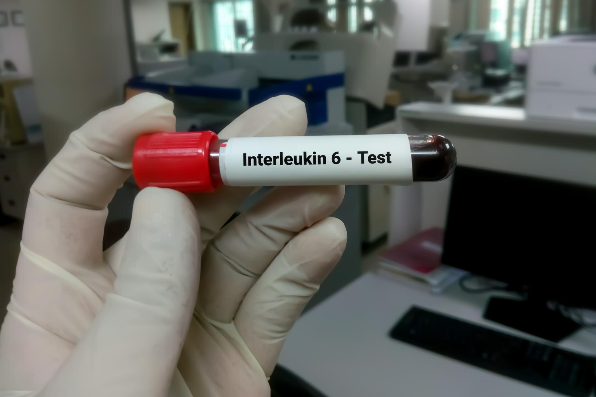 INTERLEUCINA-6 (IL-6)