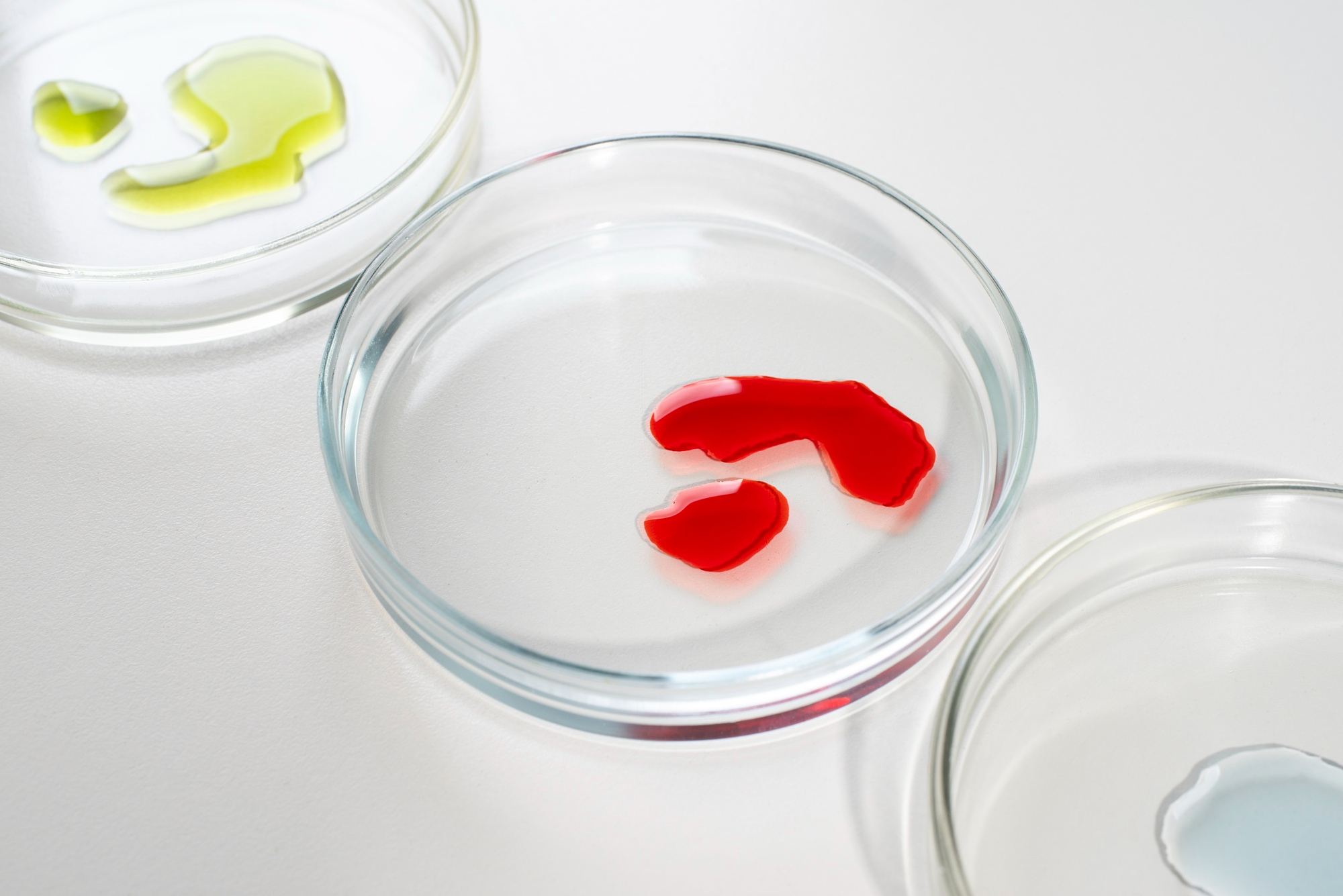 LINFOCITOS NATURAL KILLER SANG