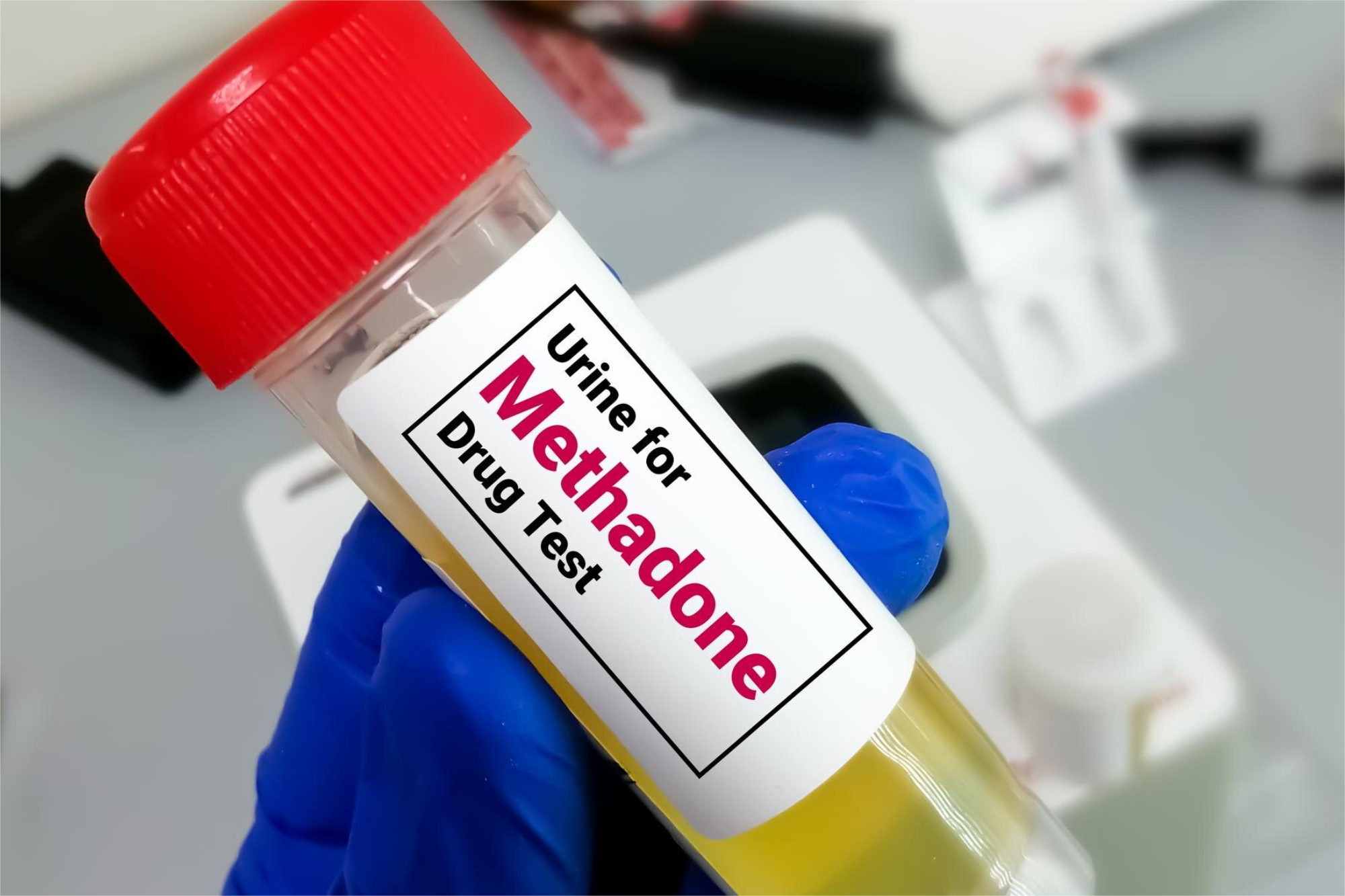 METADONA ORINA SCREENING