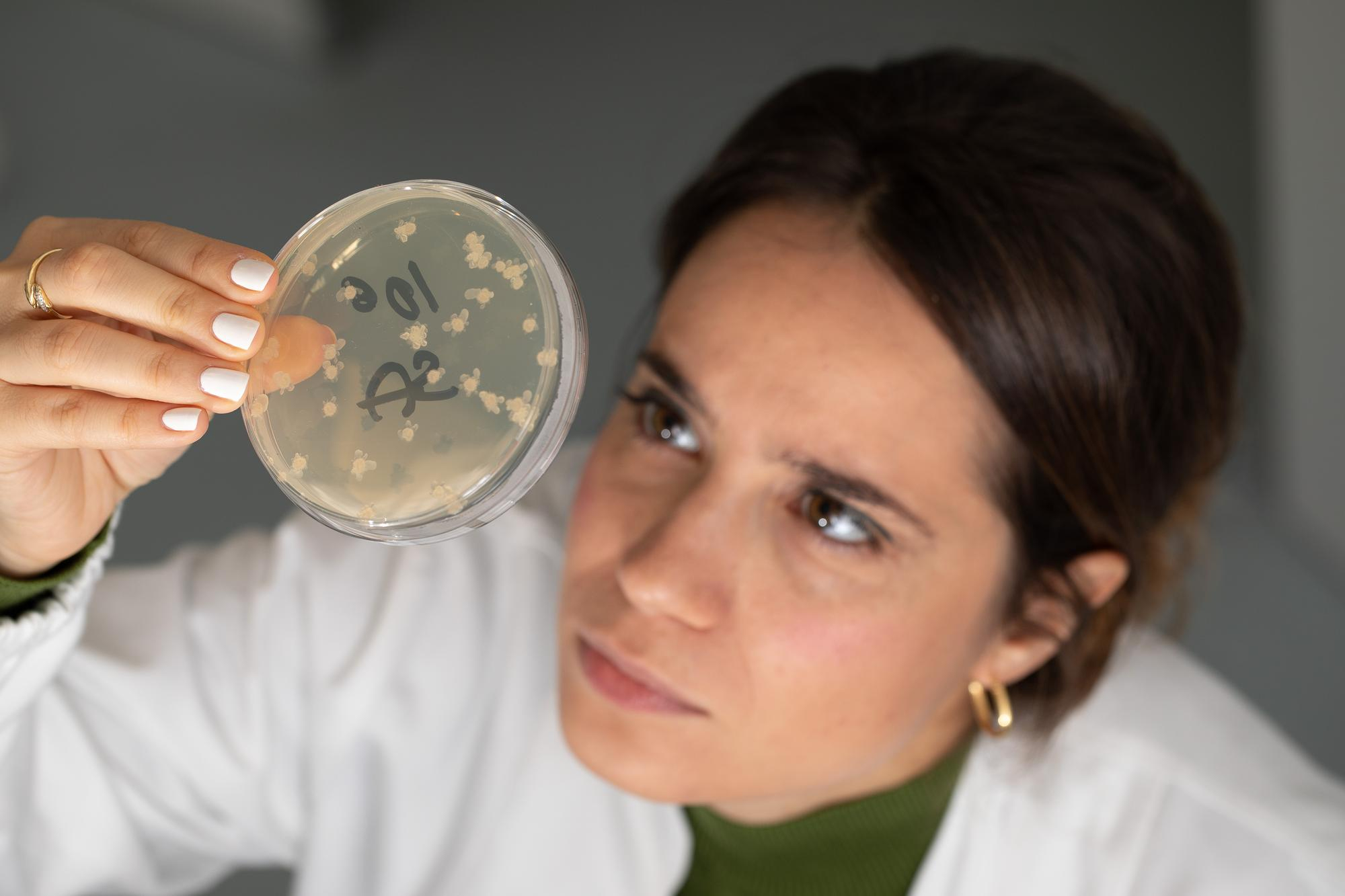 PARASITOS HECES SEGUNDA MUESTRA