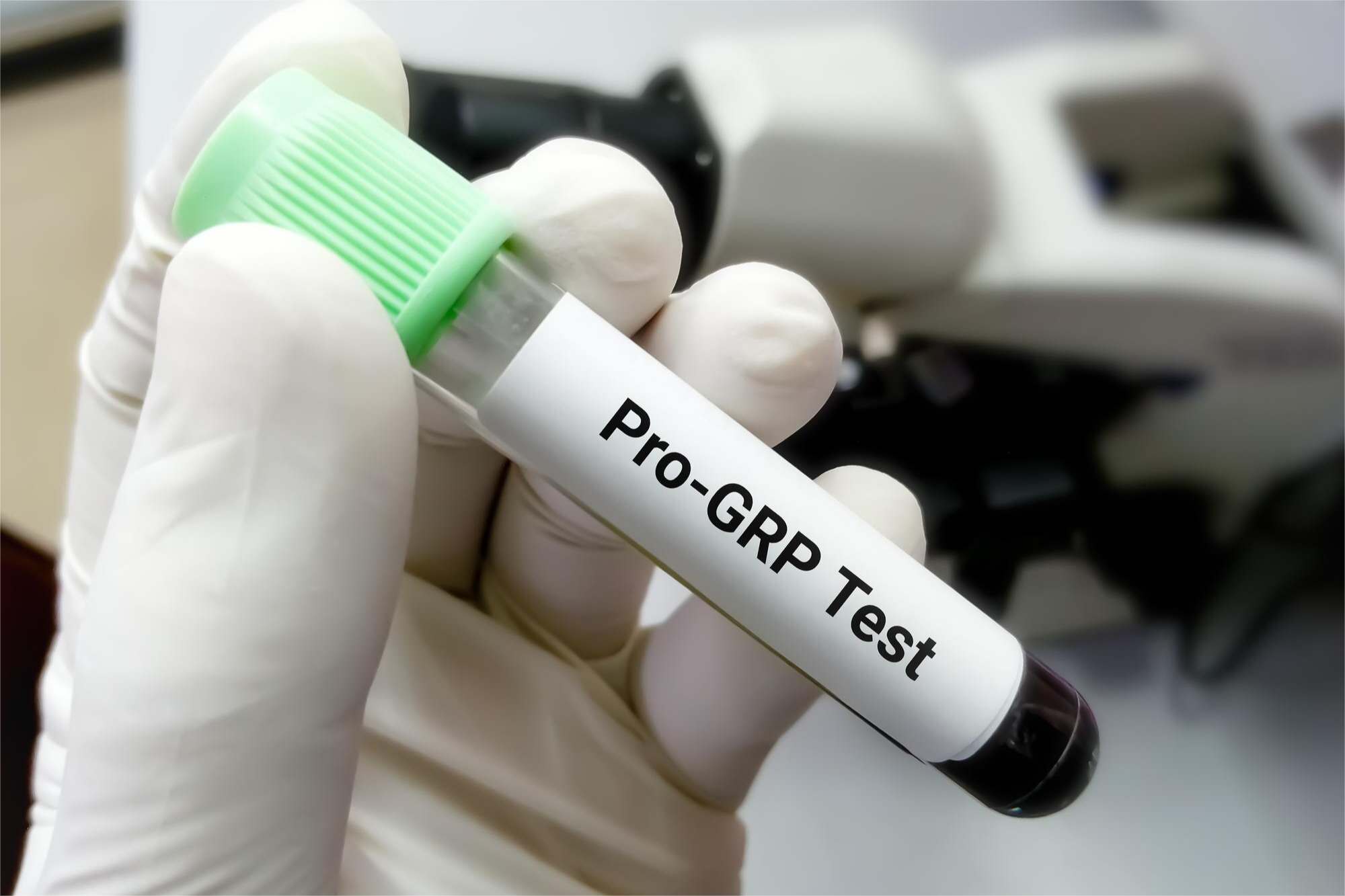 Peptido Liberador de Pro-Gastrina (Pro-GRP) en suero