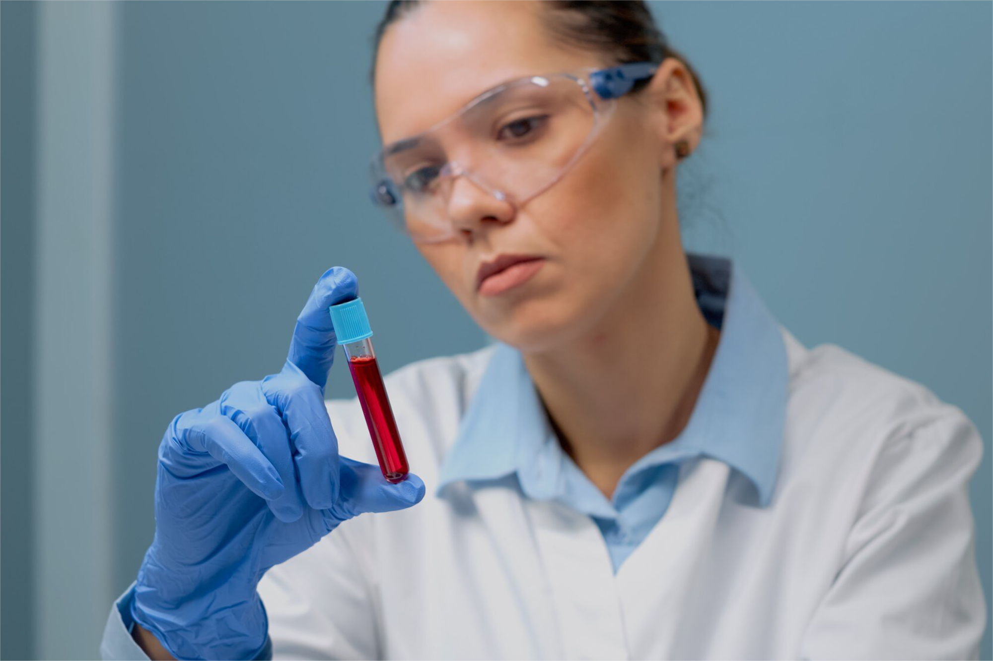 Perfil, Adrenalina en plasma