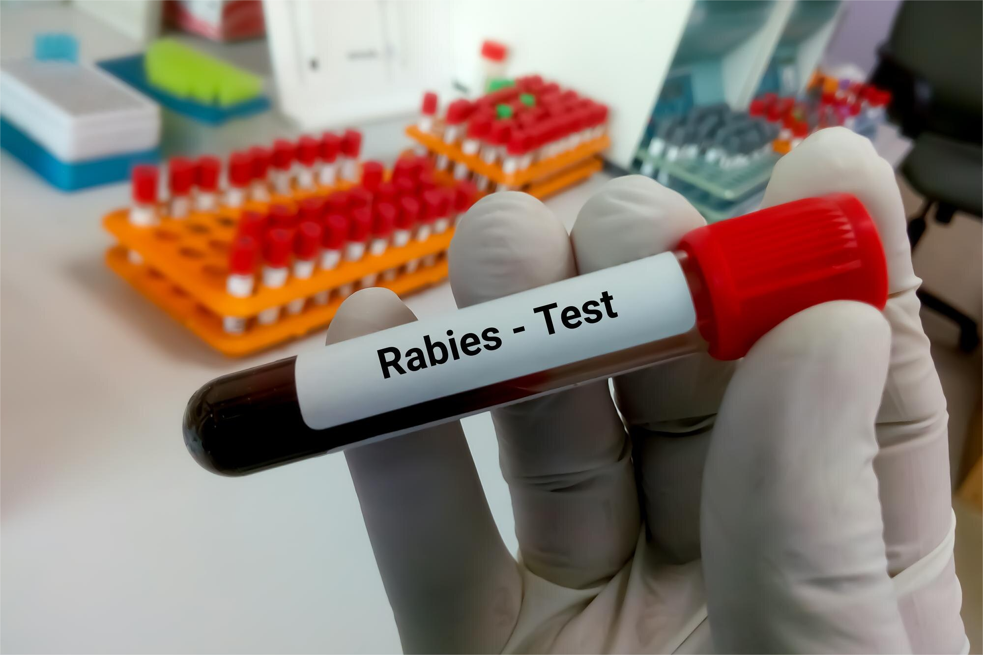 RENINA DIRECTA PLASMA