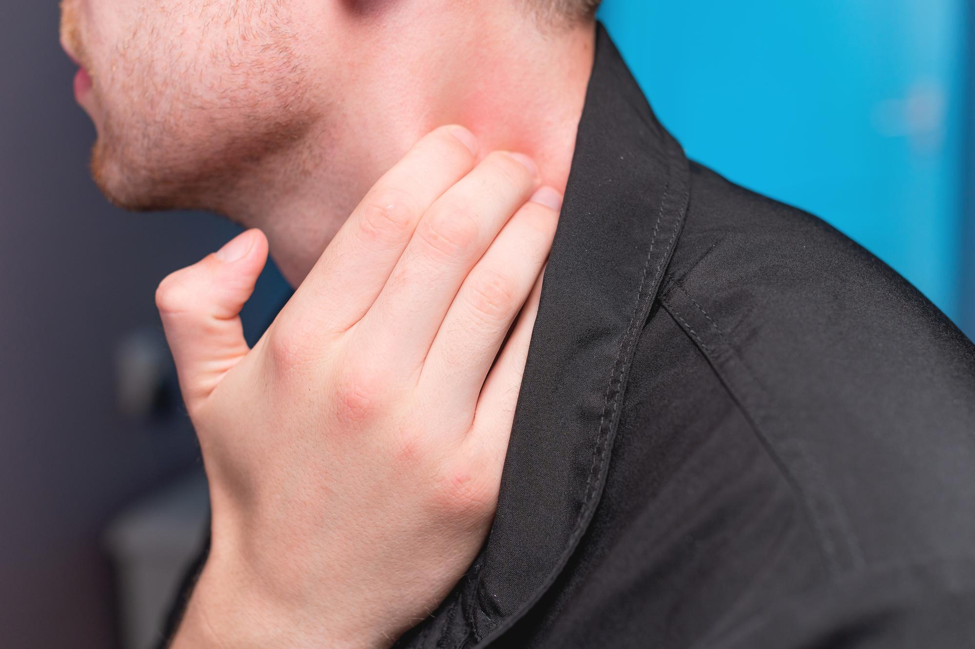 TOXOPLASMA GONDII AC. IGM