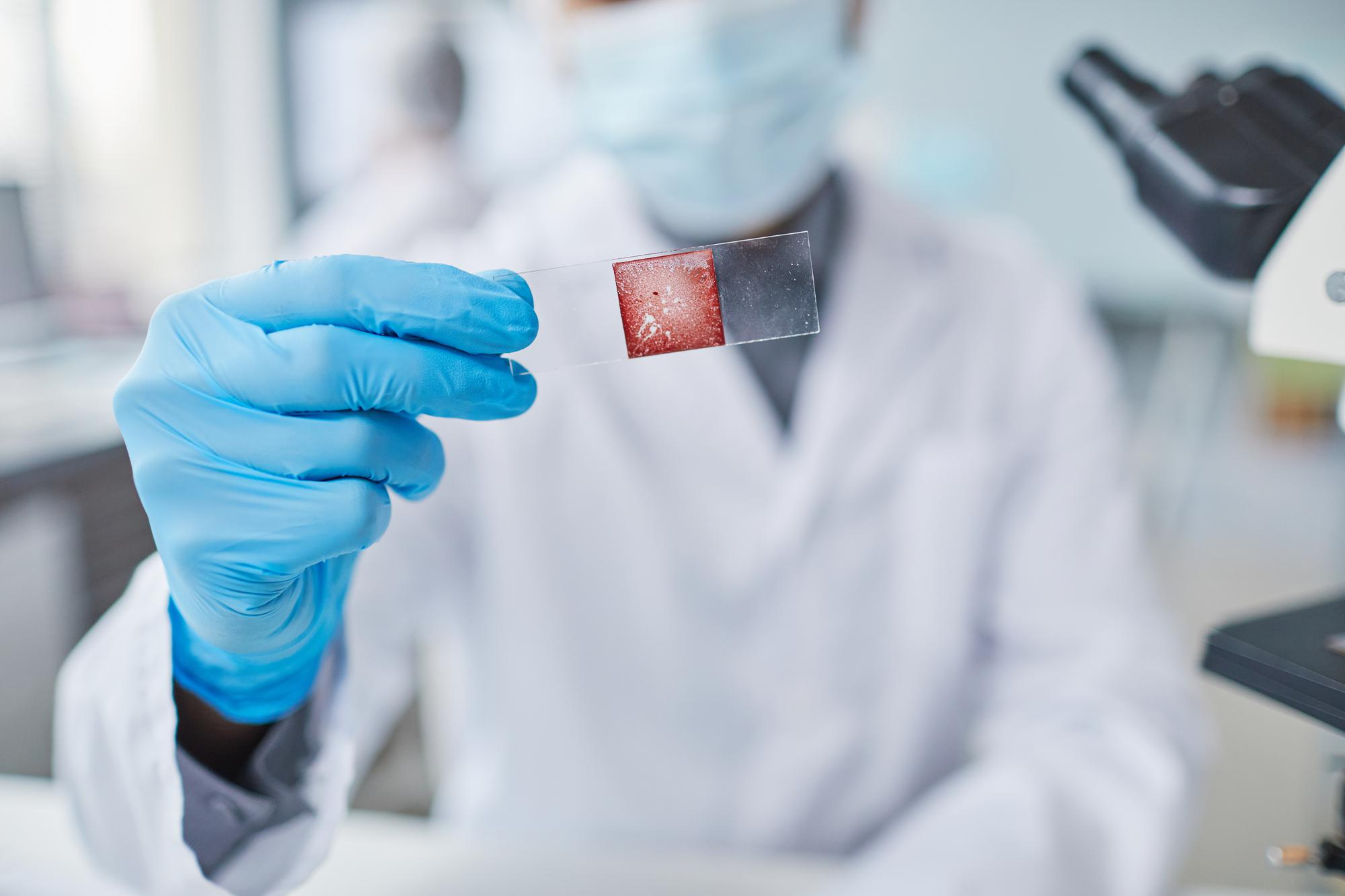 VIH AC. Y ANTÍGENO P24