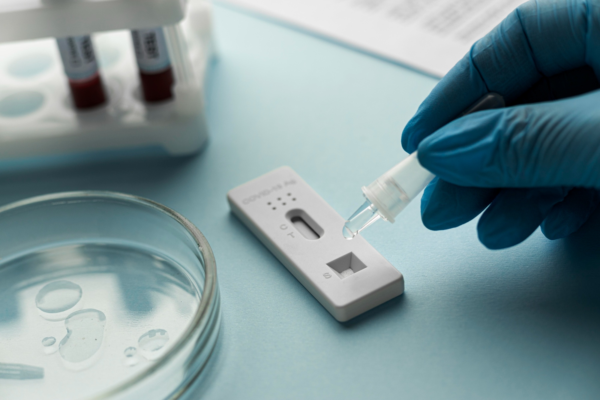 Virus Zika, RT-PCR en muestra