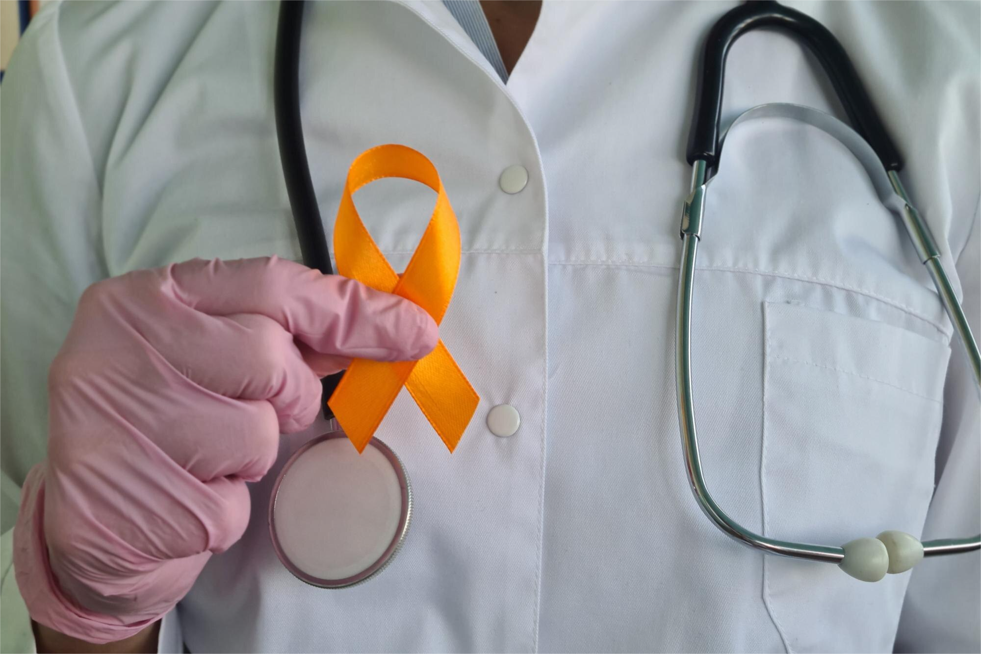 CELULAS NKT (CELULAS LGLT) SUBPOBLACIONES