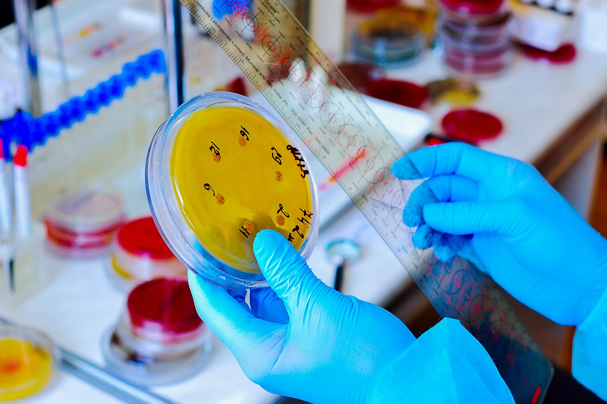 CULTIVO DE ORINA, IDENTIFICACION Y ANTIBIOGRAMA