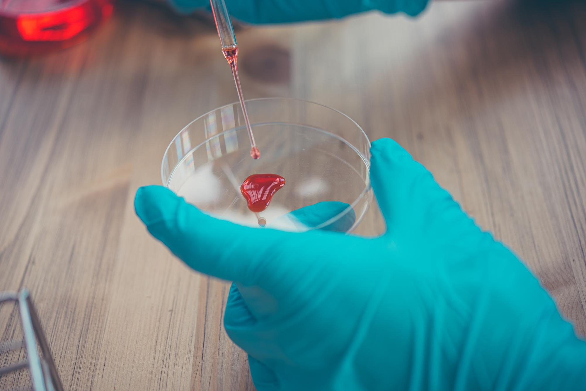 HEMOCULTIVO (CULTIVO DE SANGRE E IDENTIFICACION) SEGUNDA MUE