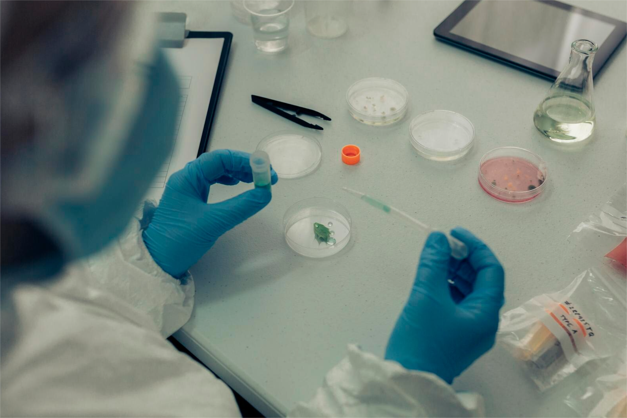 SRP (SIGNAL RECOGNITION PARTICLE) AC. SUERO